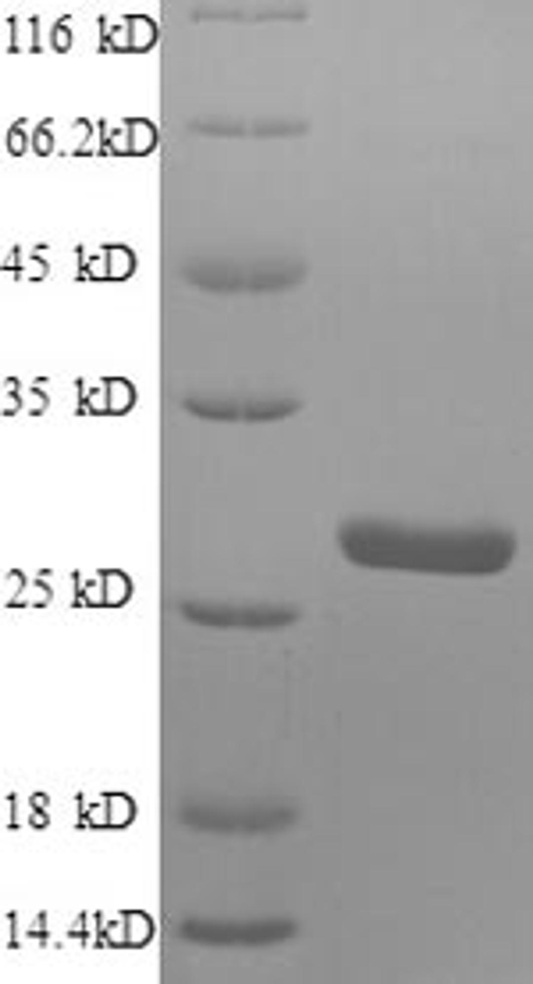 (Tris-Glycine gel) Discontinuous SDS-PAGE (reduced) with 5% enrichment gel and 15% separation gel.