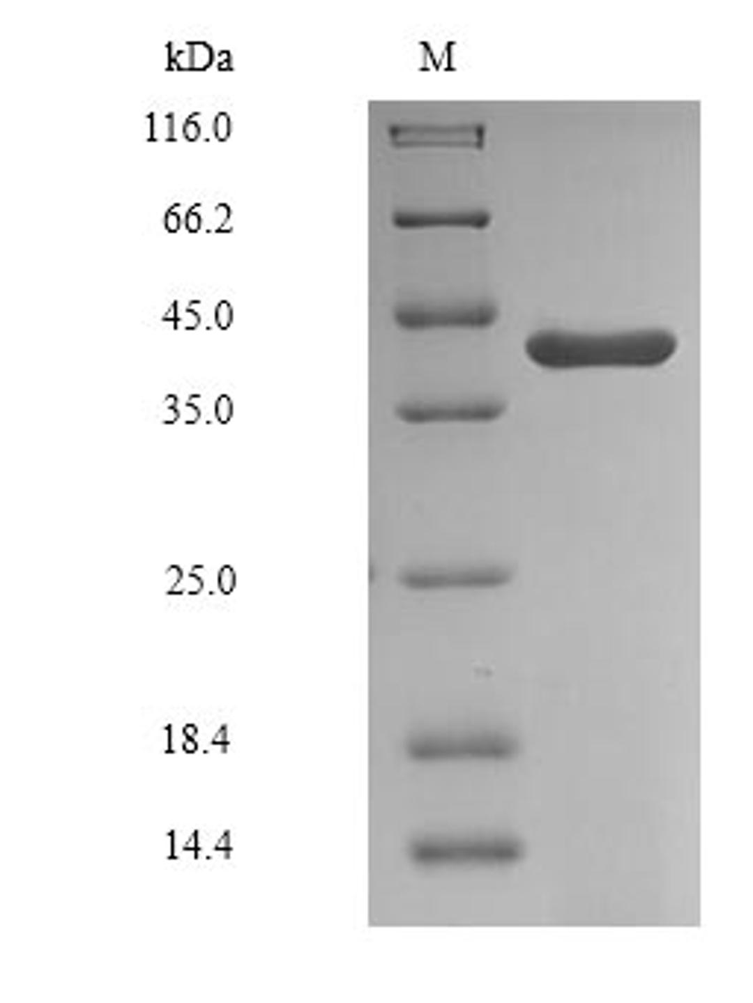 (Tris-Glycine gel) Discontinuous SDS-PAGE (reduced) with 5% enrichment gel and 15% separation gel.