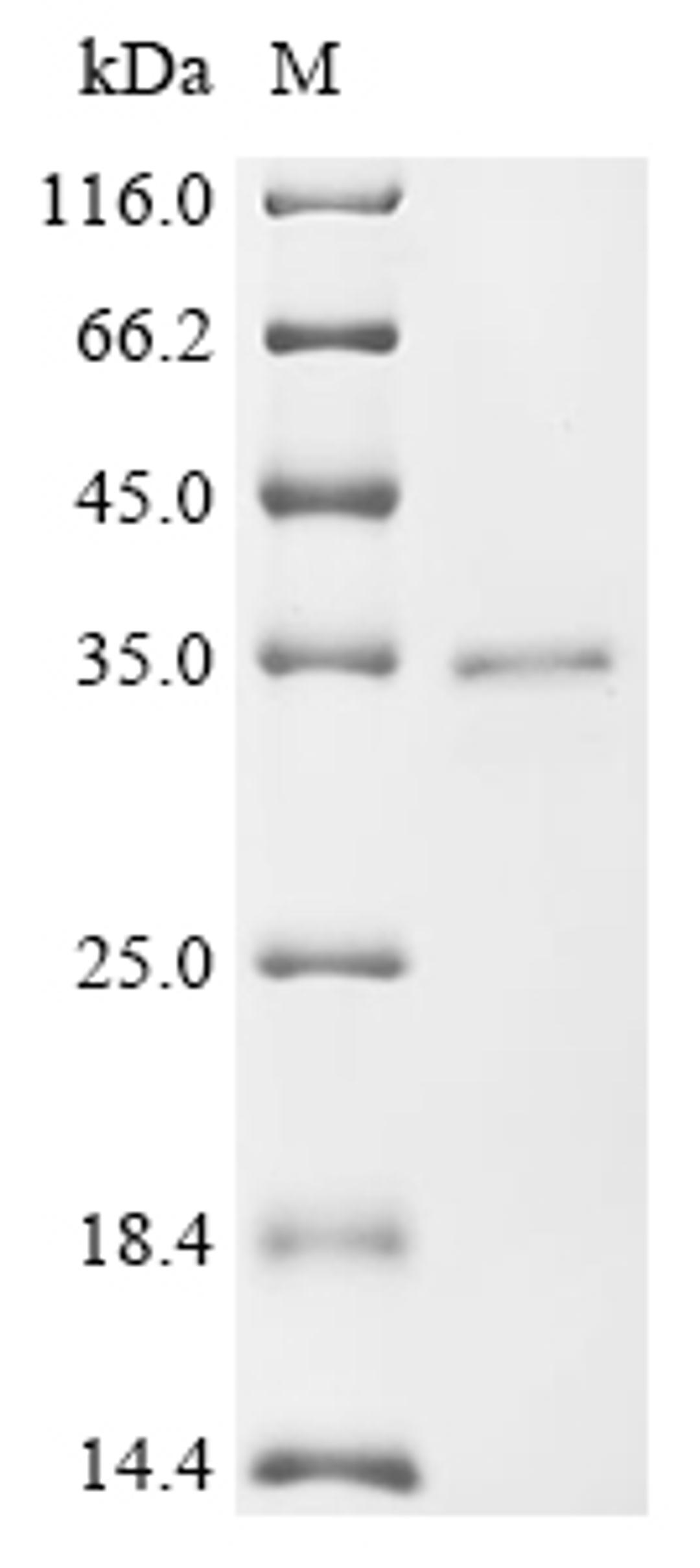 (Tris-Glycine gel) Discontinuous SDS-PAGE (reduced) with 5% enrichment gel and 15% separation gel.