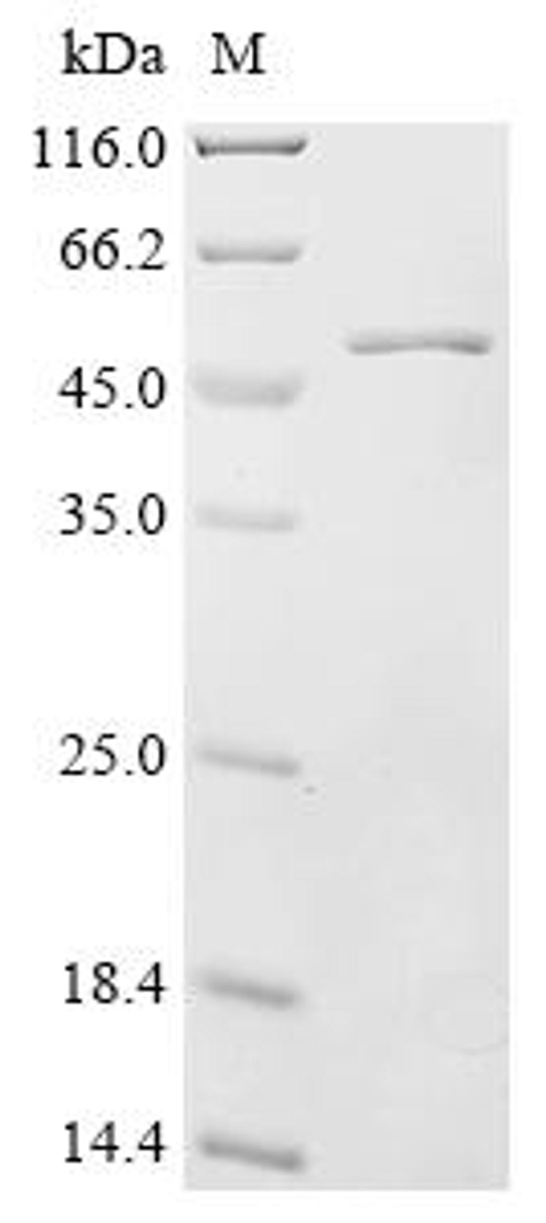 (Tris-Glycine gel) Discontinuous SDS-PAGE (reduced) with 5% enrichment gel and 15% separation gel.