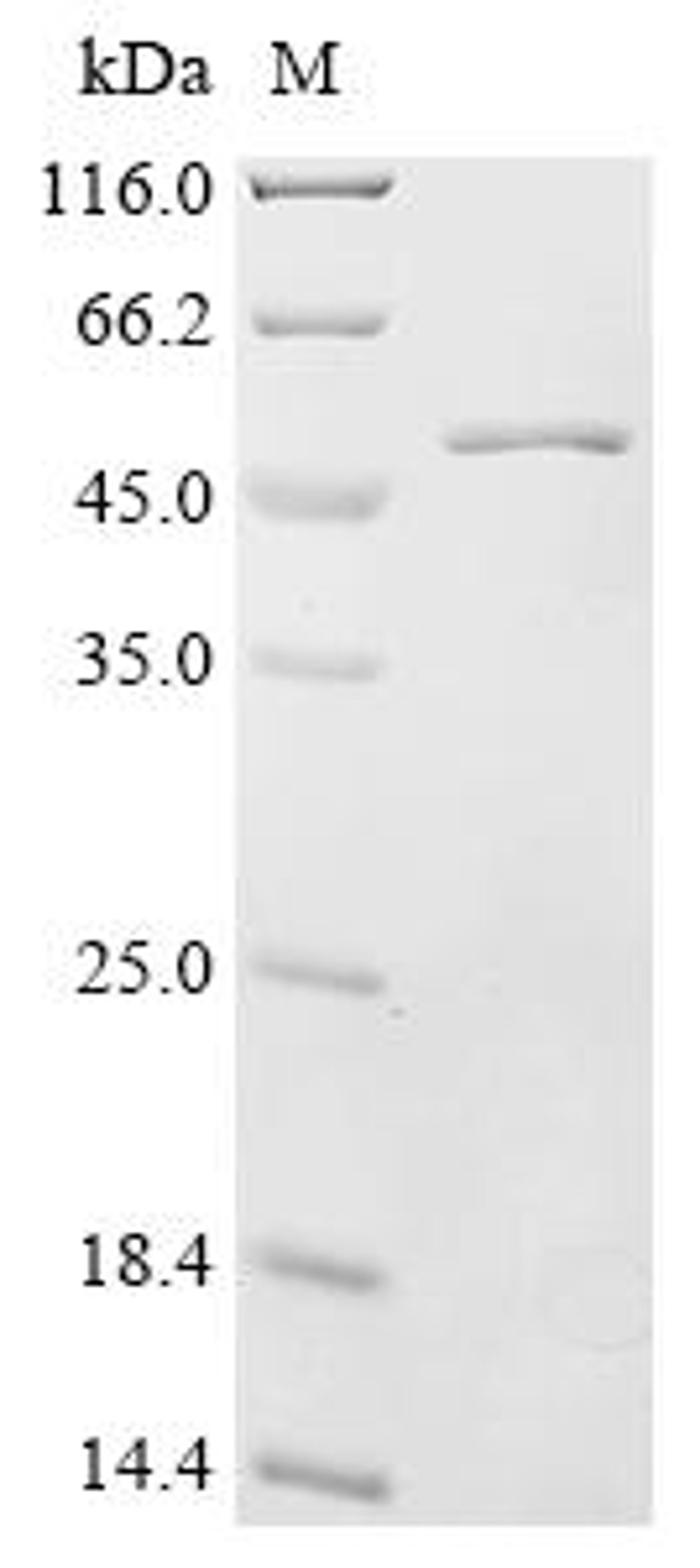 (Tris-Glycine gel) Discontinuous SDS-PAGE (reduced) with 5% enrichment gel and 15% separation gel.