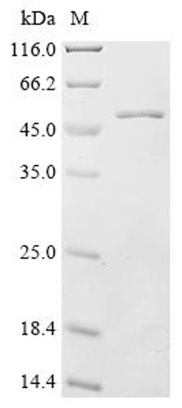 (Tris-Glycine gel) Discontinuous SDS-PAGE (reduced) with 5% enrichment gel and 15% separation gel.