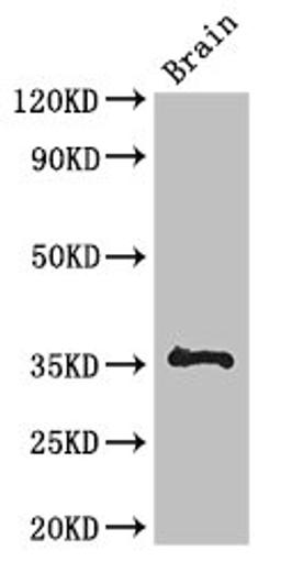 Western Blot. Positive WB detected in: Mouse brain tissue. All lanes: NPL antibody at 3µg/ml. Secondary. Goat polyclonal to rabbit IgG at 1/50000 dilution. Predicted band size: 36, 34, 32, 27, 13 kDa. Observed band size: 36 kDa