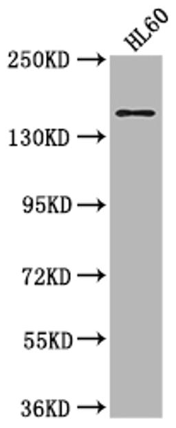 Western Blot. Positive WB detected in: HL60 whole cell lysate. All lanes: SMARCC2 antibody at 1:2000. Secondary. Goat polyclonal to rabbit IgG at 1/50000 dilution. Predicted band size: 133, 125, 127 kDa. Observed band size: 170 kDa. 