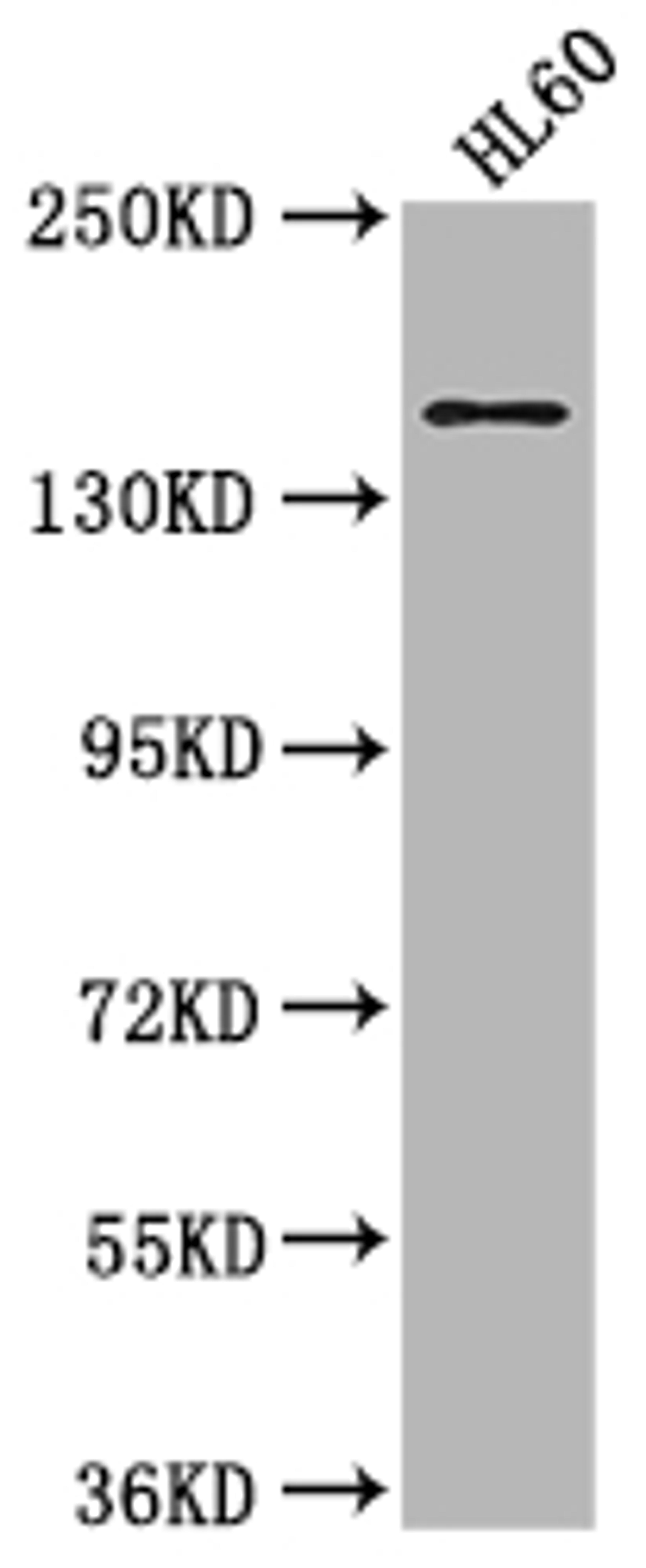 Western Blot. Positive WB detected in: HL60 whole cell lysate. All lanes: SMARCC2 antibody at 1:2000. Secondary. Goat polyclonal to rabbit IgG at 1/50000 dilution. Predicted band size: 133, 125, 127 kDa. Observed band size: 170 kDa. 