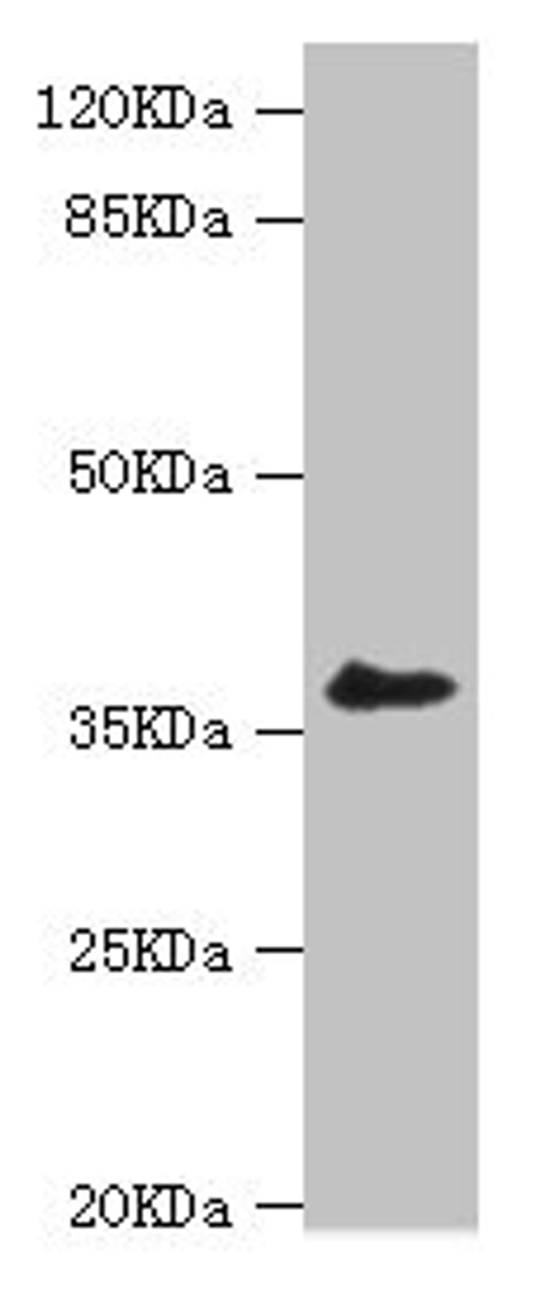 Western blot. All lanes: LIMS1 antibody at 0.93ug/ml + A549 whole cell lysate. Secondary. Goat polyclonal to rabbit IgG at 1/10000 dilution. Predicted band size: 38, 39, 45, 42 kDa. Observed band size: 38 kDa. 