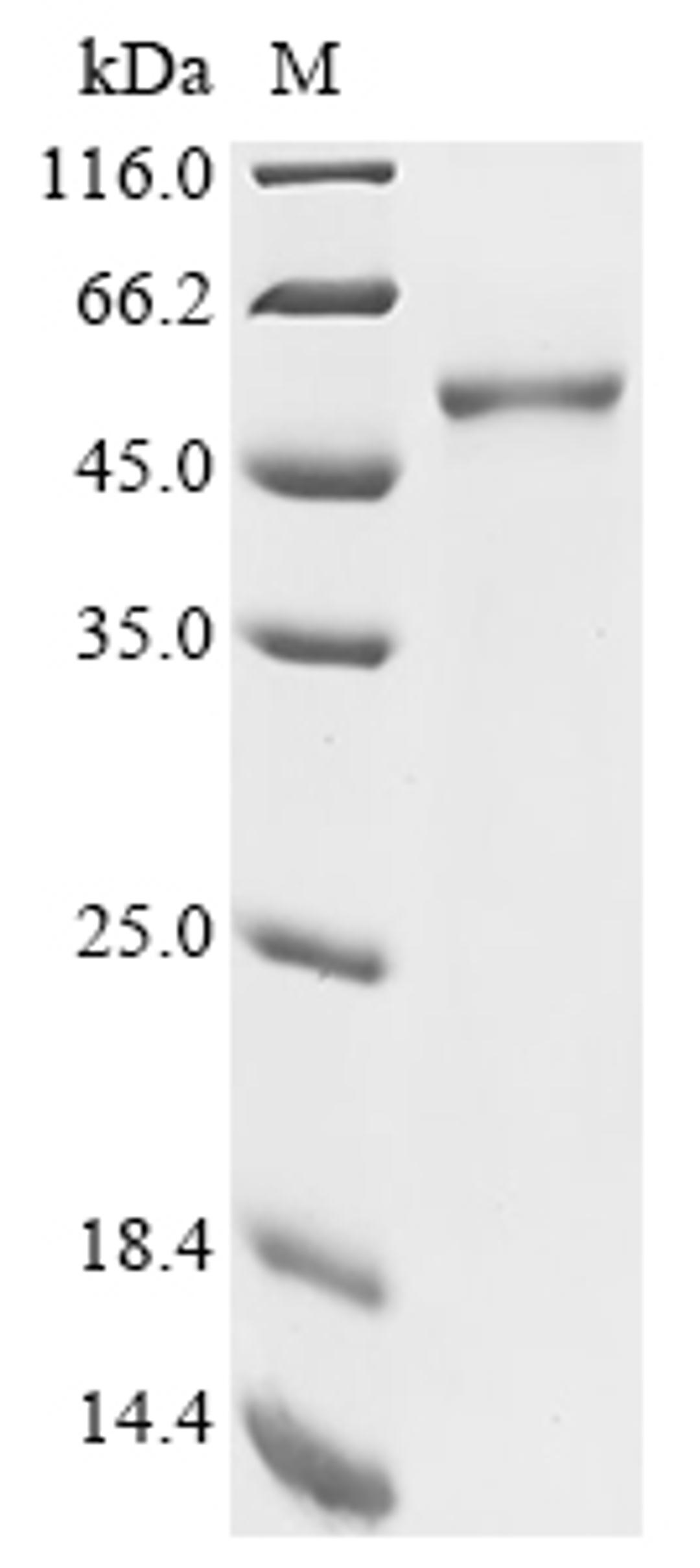 (Tris-Glycine gel) Discontinuous SDS-PAGE (reduced) with 5% enrichment gel and 15% separation gel.