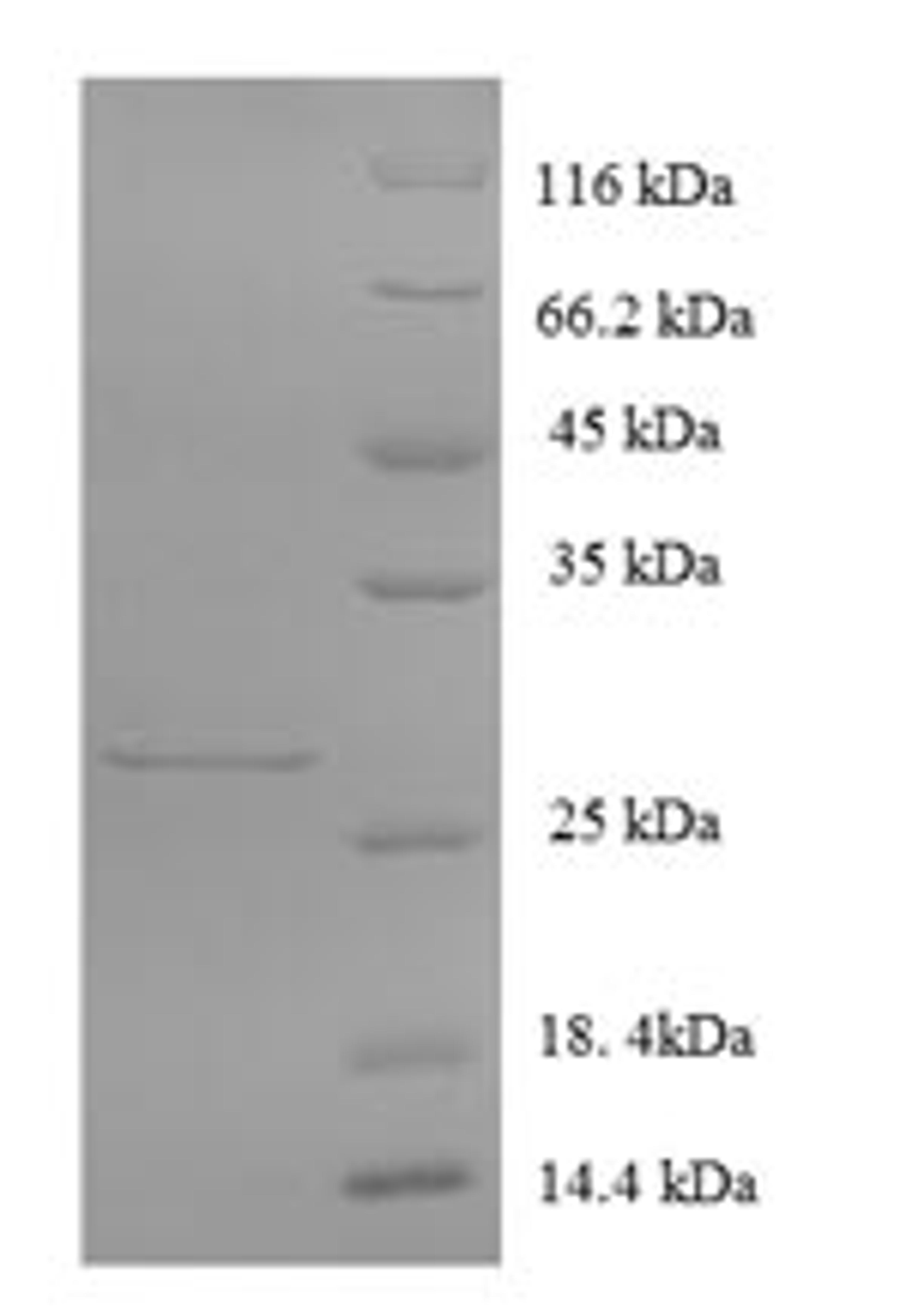 (Tris-Glycine gel) Discontinuous SDS-PAGE (reduced) with 5% enrichment gel and 15% separation gel.
