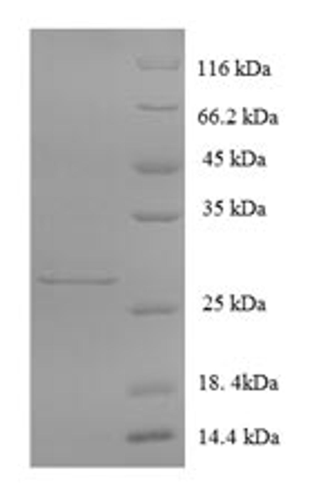 (Tris-Glycine gel) Discontinuous SDS-PAGE (reduced) with 5% enrichment gel and 15% separation gel.