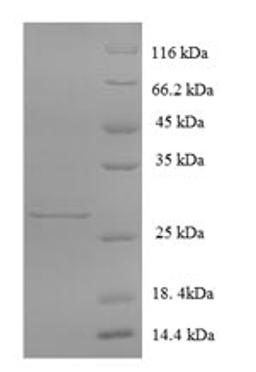 (Tris-Glycine gel) Discontinuous SDS-PAGE (reduced) with 5% enrichment gel and 15% separation gel.