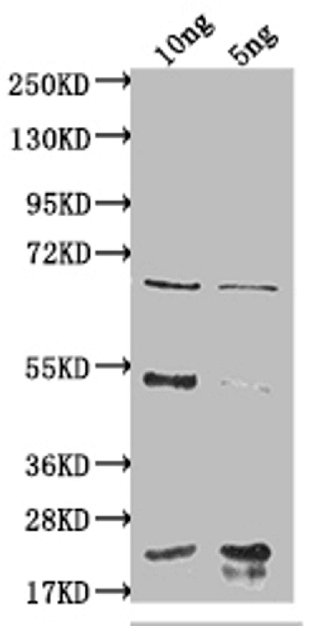 Western Blot. Positive WB detected in Recombinant protein. All lanes: degP antibody at 1:2000. Secondary. Goat polyclonal to rabbit IgG at 1/50000 dilution. Predicted band size: 62.8 kDa. Observed band size: 65 kDa. 