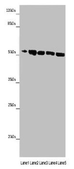 Western blot. All lanes: MINPP1 antibody at 14ug/ml. Lane 1: Jurkat whole cell lysate. Lane 2: U251 whole cell lysate. Lane 3: K562 whole cell lysate. Lane 4: Hela whole cell lysate. Lane 5: HepG2 whole cell lysate. Secondary. Goat polyclonal to rabbit IgG at 1/10000 dilution. Predicted band size: 56, 35, 32, 34 kDa. Observed band size: 56 kDa. 