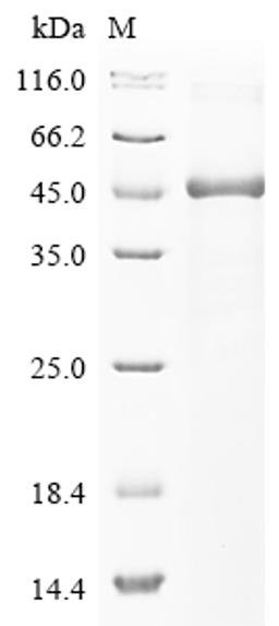 (Tris-Glycine gel) Discontinuous SDS-PAGE (reduced) with 5% enrichment gel and 15% separation gel.