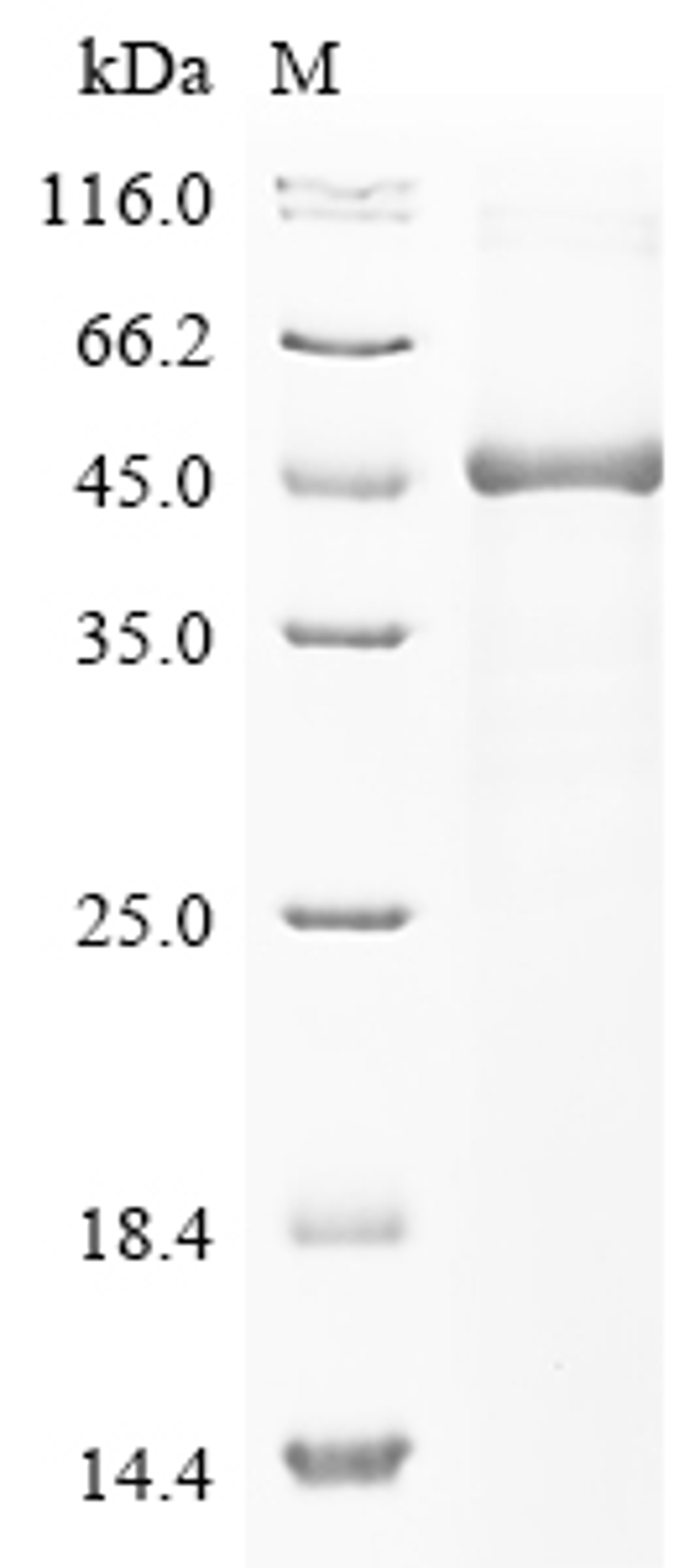 (Tris-Glycine gel) Discontinuous SDS-PAGE (reduced) with 5% enrichment gel and 15% separation gel.