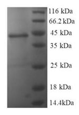 (Tris-Glycine gel) Discontinuous SDS-PAGE (reduced) with 5% enrichment gel and 15% separation gel.