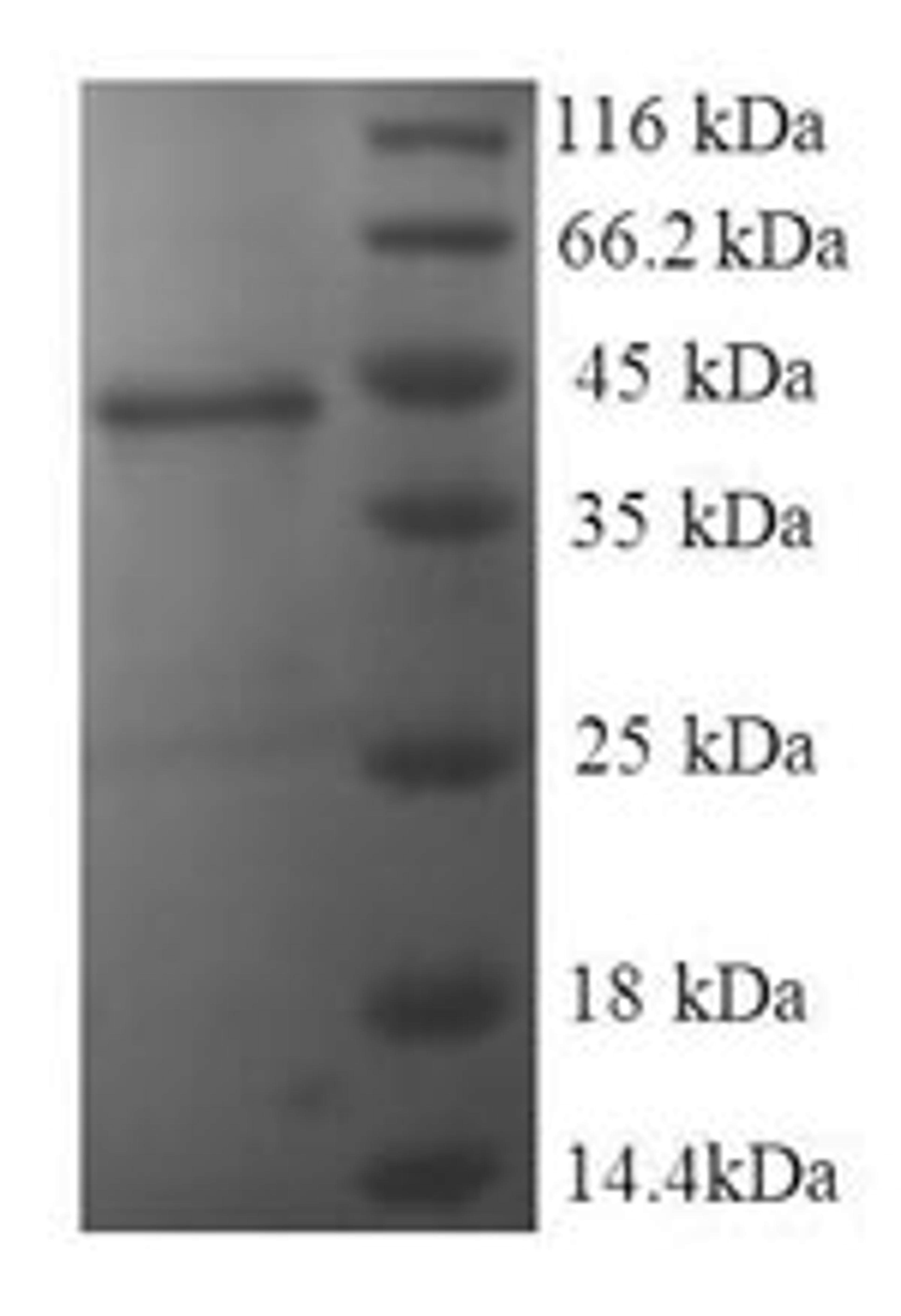(Tris-Glycine gel) Discontinuous SDS-PAGE (reduced) with 5% enrichment gel and 15% separation gel.