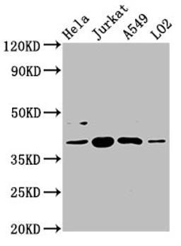 Western Blot. Positive WB detected in: Hela whole cell lysate, Jurkat whole cell lysate, A549 whole cell lysate, LO2 whole cell lysate. All lanes: SHARPIN antibody at 5.4µg/ml. Secondary. Goat polyclonal to rabbit IgG at 1/50000 dilution. Predicted band size: 40, 34 kDa. Observed band size: 40 kDa