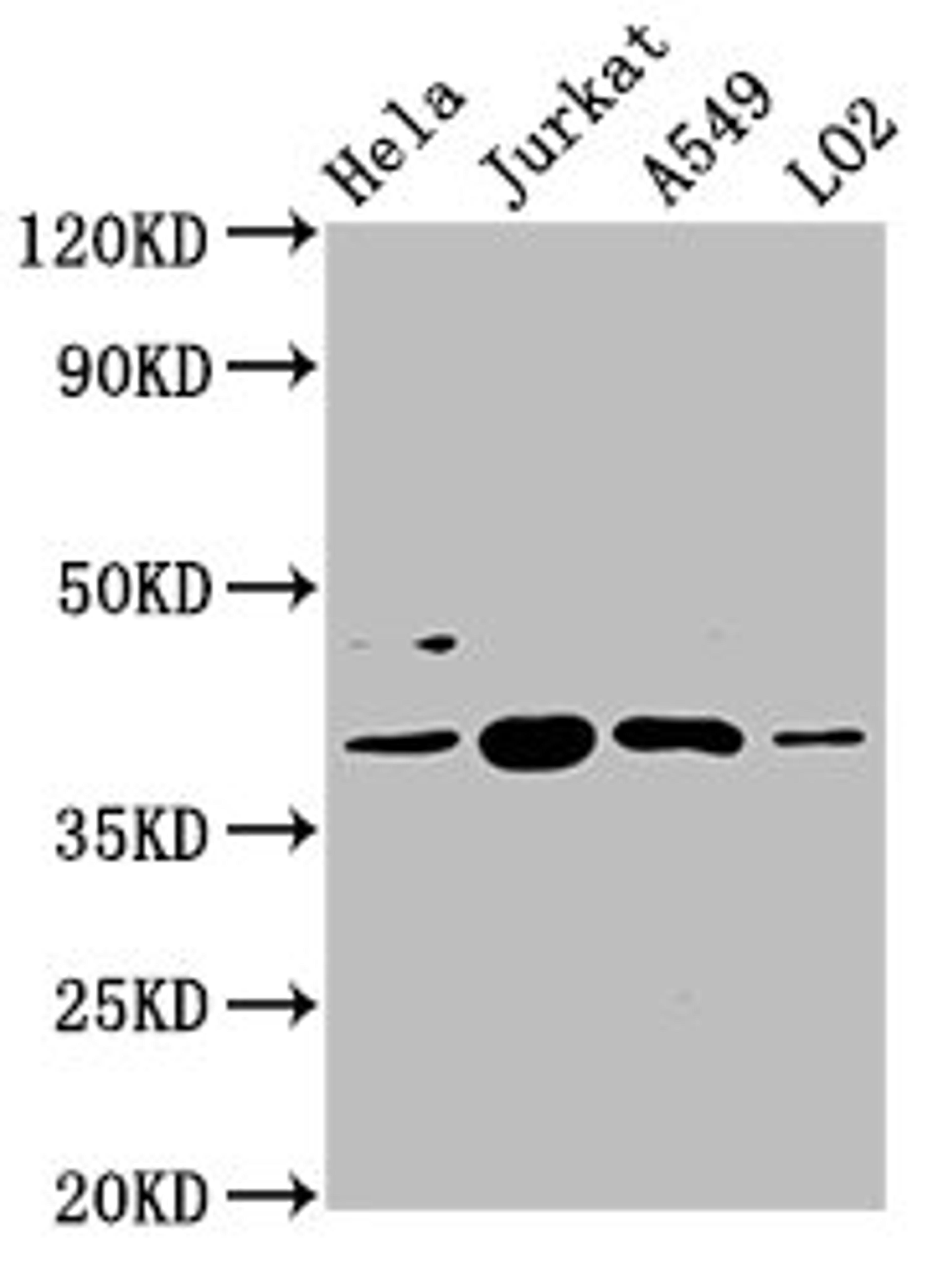 Western Blot. Positive WB detected in: Hela whole cell lysate, Jurkat whole cell lysate, A549 whole cell lysate, LO2 whole cell lysate. All lanes: SHARPIN antibody at 5.4µg/ml. Secondary. Goat polyclonal to rabbit IgG at 1/50000 dilution. Predicted band size: 40, 34 kDa. Observed band size: 40 kDa