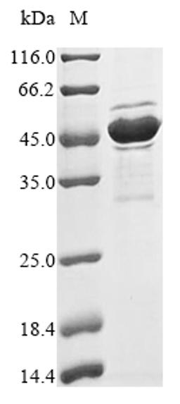 (Tris-Glycine gel) Discontinuous SDS-PAGE (reduced) with 5% enrichment gel and 15% separation gel.