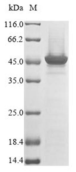 (Tris-Glycine gel) Discontinuous SDS-PAGE (reduced) with 5% enrichment gel and 15% separation gel.