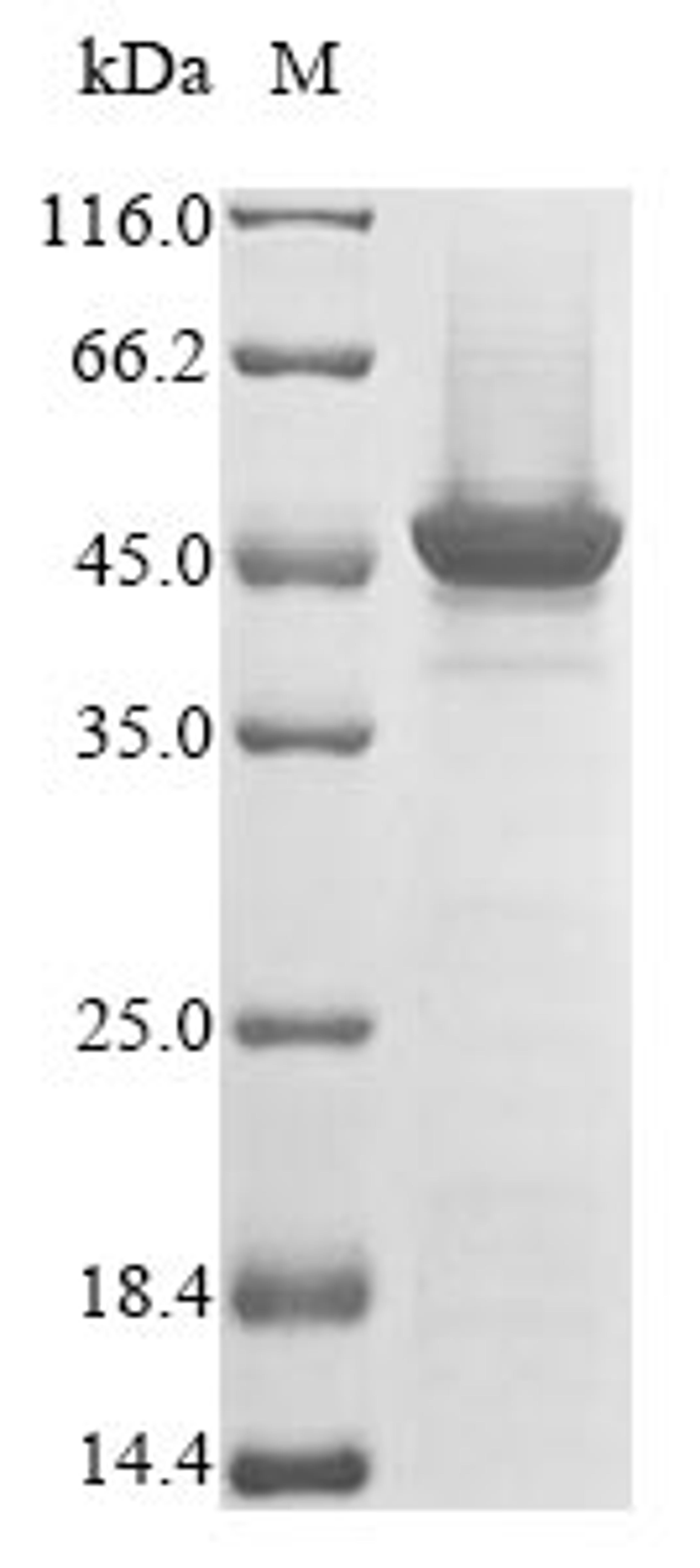 (Tris-Glycine gel) Discontinuous SDS-PAGE (reduced) with 5% enrichment gel and 15% separation gel.