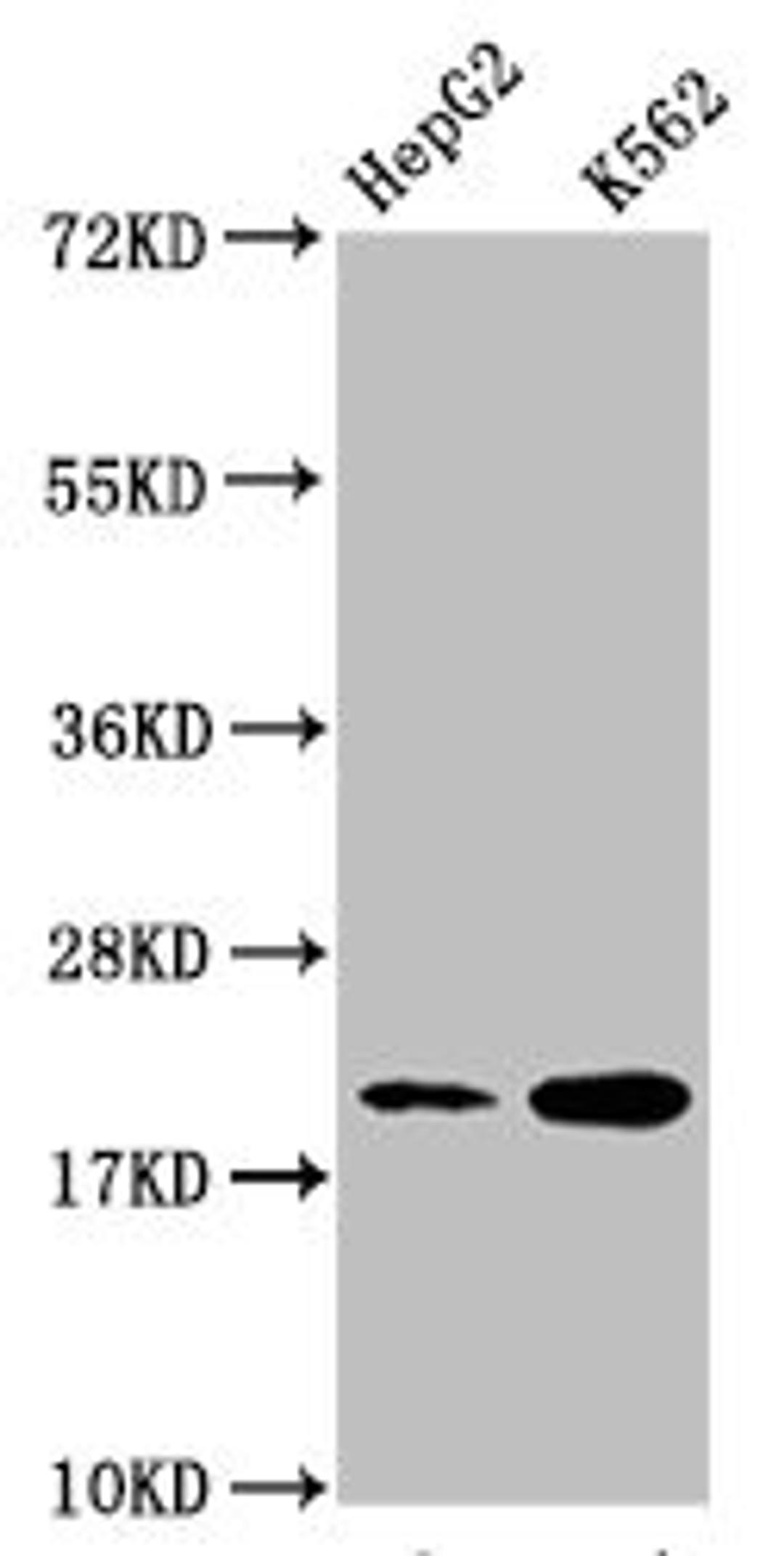 Western Blot. Positive WB detected in: HepG2 whole cell lysate, K562 whole cell lysate. All lanes: HIST1H1C antibody at 1:500. Secondary. Goat polyclonal to rabbit IgG at 1/40000 dilution. Predicted band size: 22 kDa. Observed band size: 22 kDa