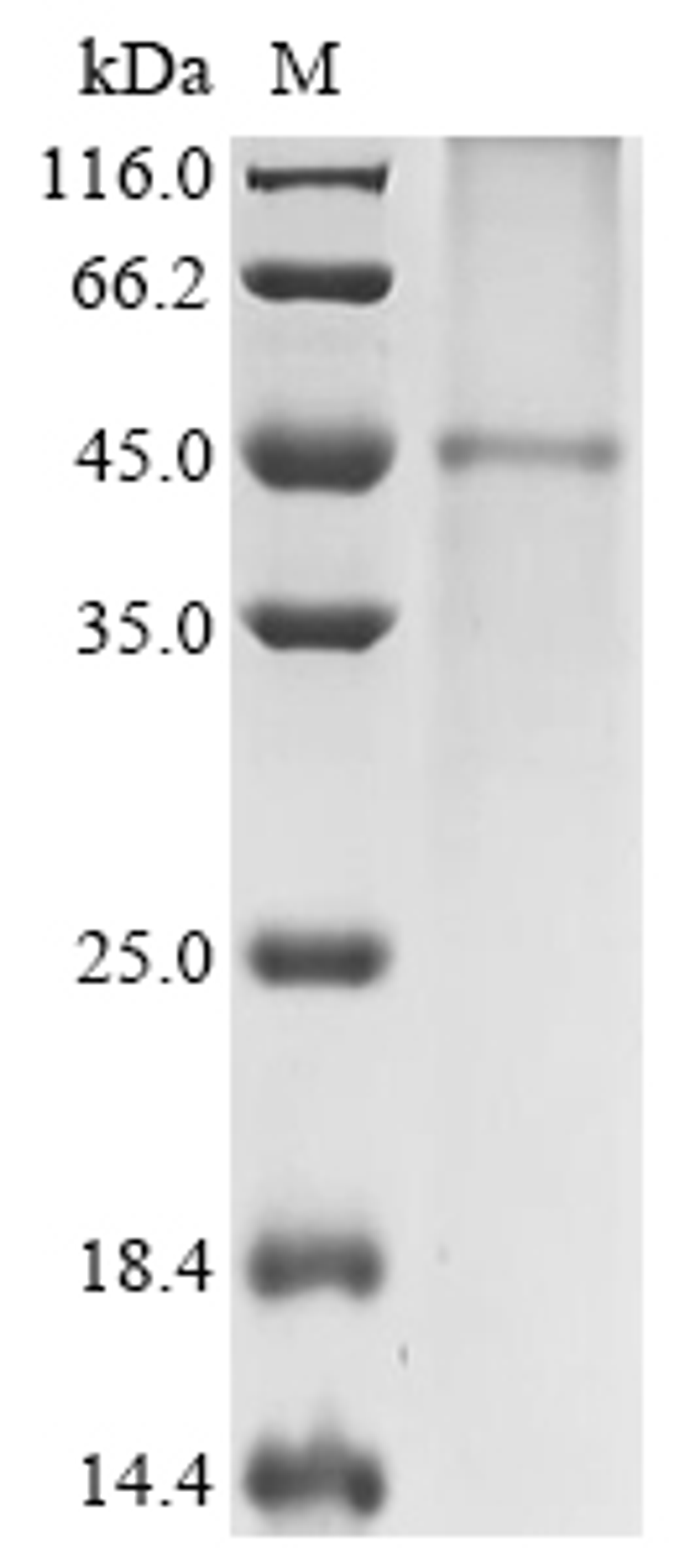 (Tris-Glycine gel) Discontinuous SDS-PAGE (reduced) with 5% enrichment gel and 15% separation gel.