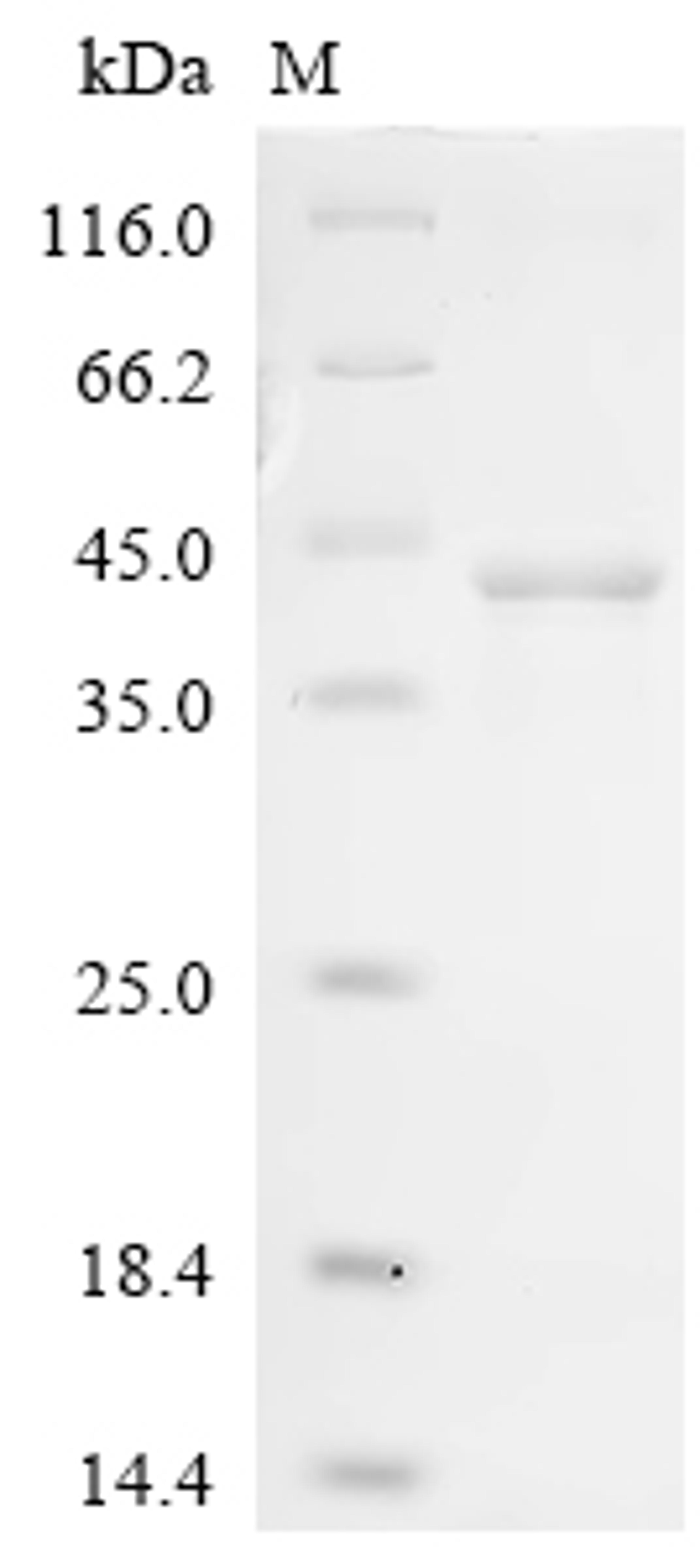 (Tris-Glycine gel) Discontinuous SDS-PAGE (reduced) with 5% enrichment gel and 15% separation gel.