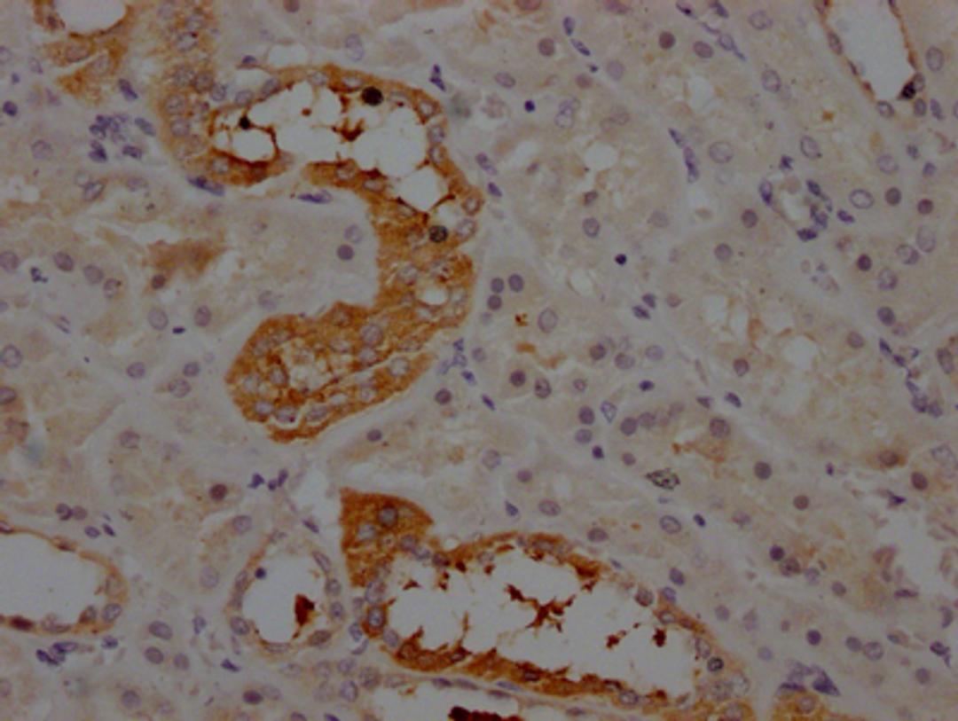 IHC image of CSB-RA263831A0HU diluted at 1:100 and staining in paraffin-embedded human kidney tissue performed on a Leica BondTM system. After dewaxing and hydration, antigen retrieval was mediated by high pressure in a citrate buffer (pH 6.0). Section was blocked with 10% normal goat serum 30min at RT. Then primary antibody (1% BSA) was incubated at 4℃ overnight. The primary is detected by a Goat anti-rabbit IgG polymer labeled by HRP and visualized using 0.05% DAB.