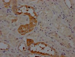 IHC image of CSB-RA263831A0HU diluted at 1:100 and staining in paraffin-embedded human kidney tissue performed on a Leica BondTM system. After dewaxing and hydration, antigen retrieval was mediated by high pressure in a citrate buffer (pH 6.0). Section was blocked with 10% normal goat serum 30min at RT. Then primary antibody (1% BSA) was incubated at 4℃ overnight. The primary is detected by a Goat anti-rabbit IgG polymer labeled by HRP and visualized using 0.05% DAB.