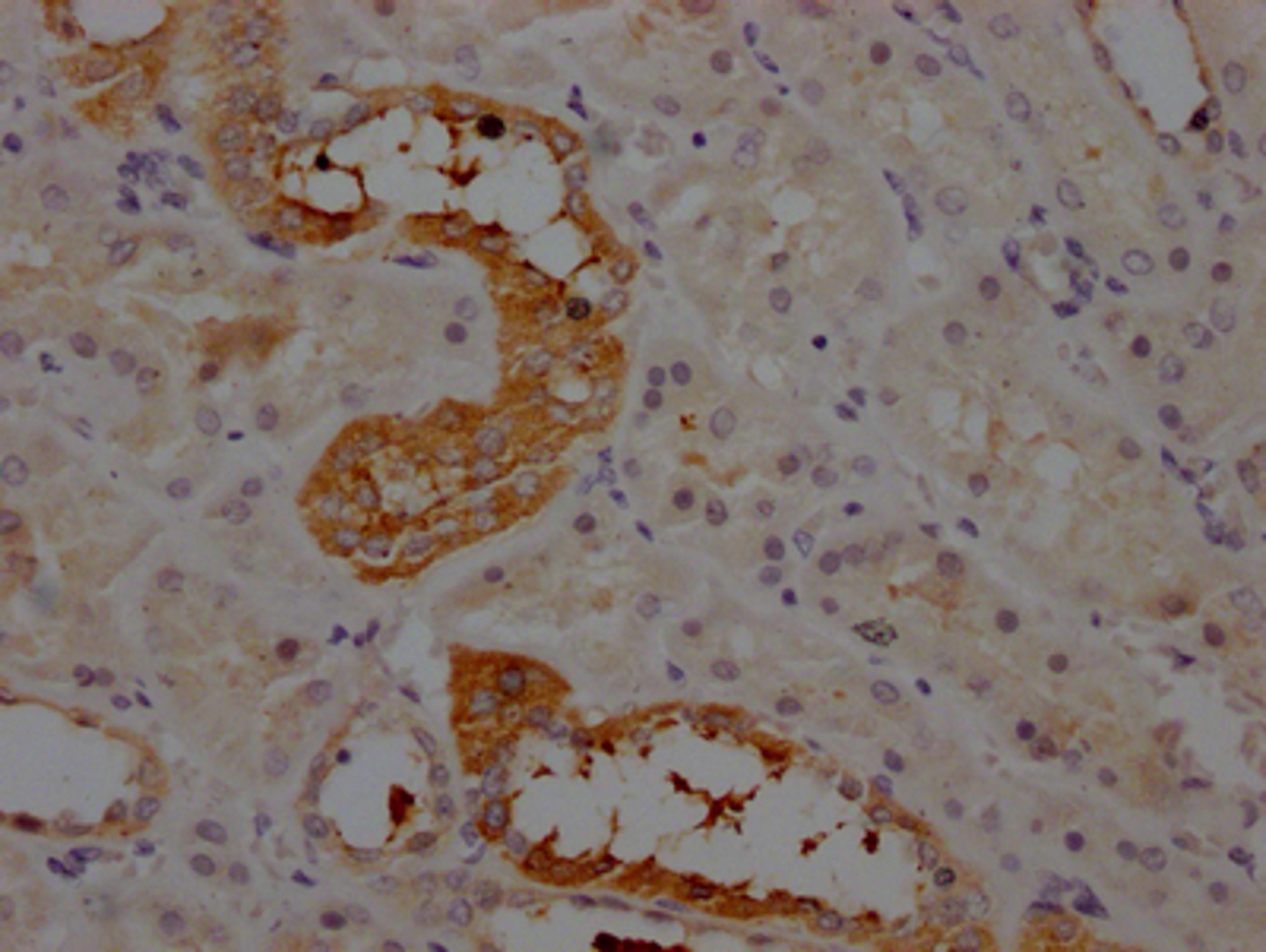 IHC image of CSB-RA263831A0HU diluted at 1:100 and staining in paraffin-embedded human kidney tissue performed on a Leica BondTM system. After dewaxing and hydration, antigen retrieval was mediated by high pressure in a citrate buffer (pH 6.0). Section was blocked with 10% normal goat serum 30min at RT. Then primary antibody (1% BSA) was incubated at 4℃ overnight. The primary is detected by a Goat anti-rabbit IgG polymer labeled by HRP and visualized using 0.05% DAB.