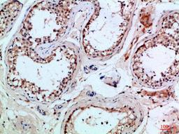 Immunohistochemical analysis of paraffin-embedded Human-testis, antibody was diluted at 1:100