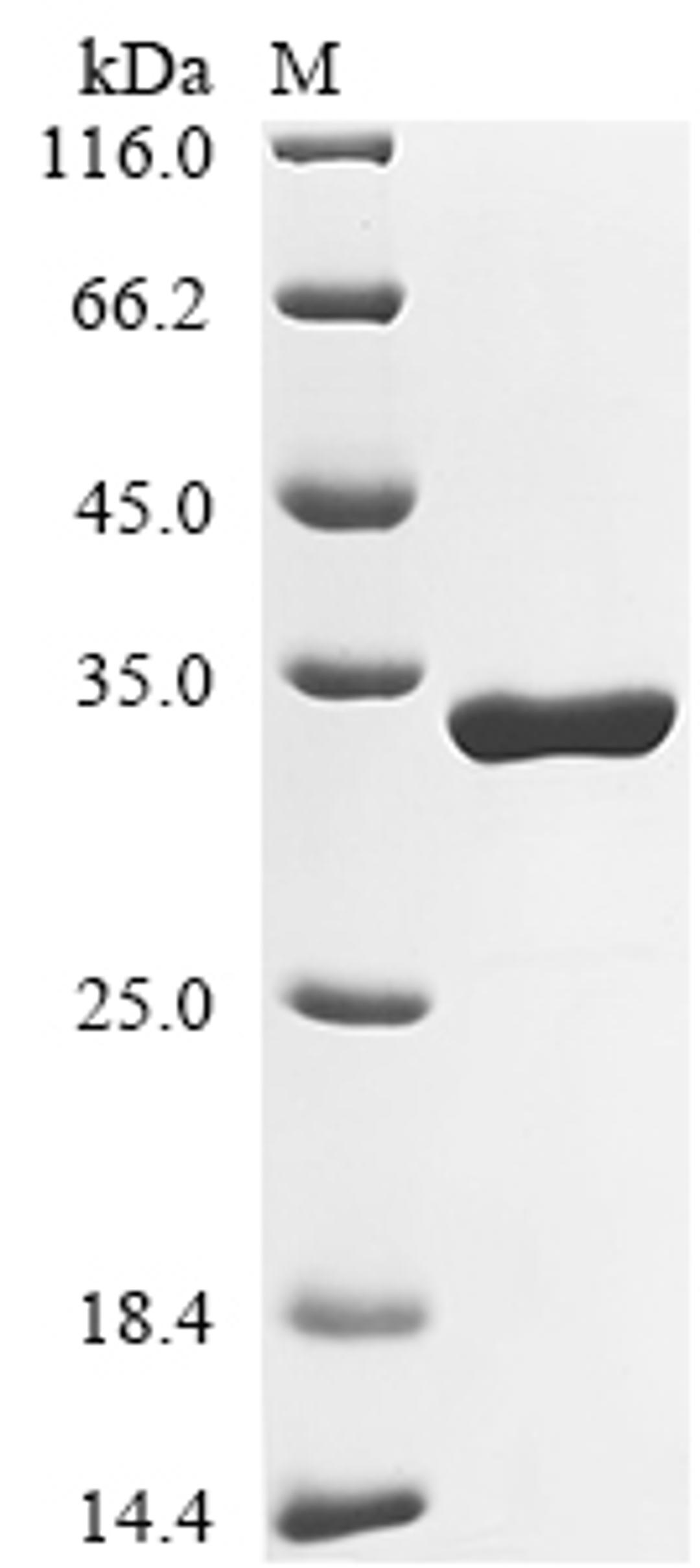(Tris-Glycine gel) Discontinuous SDS-PAGE (reduced) with 5% enrichment gel and 15% separation gel.