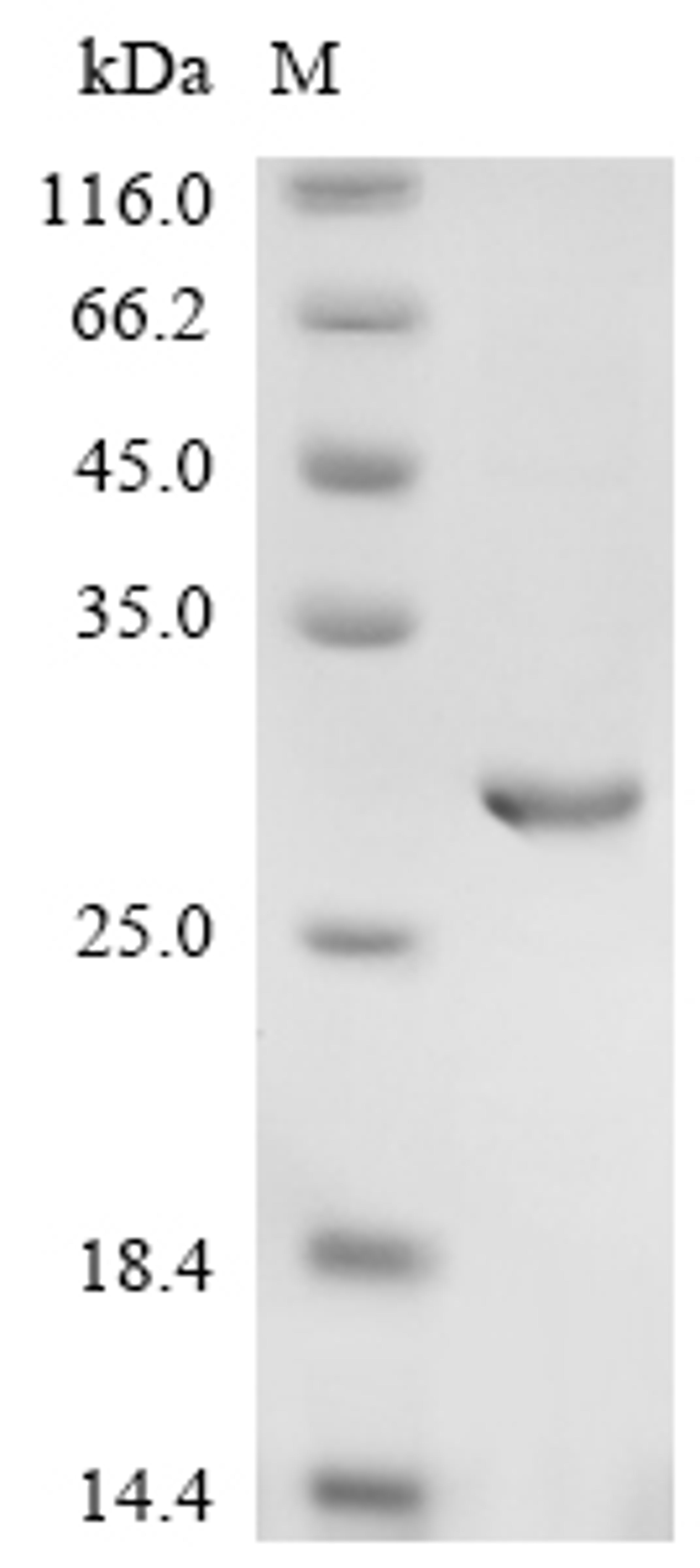 (Tris-Glycine gel) Discontinuous SDS-PAGE (reduced) with 5% enrichment gel and 15% separation gel.