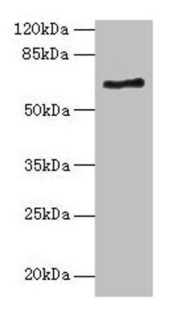 Western blot. All lanes: ALAS2 antibody at 6µg/ml + K562 whole cell lysate. Secondary. Goat polyclonal to rabbit IgG at 1/10000 dilution. Predicted band size: 65, 61, 50, 64 kDa. Observed band size: 65 kDa