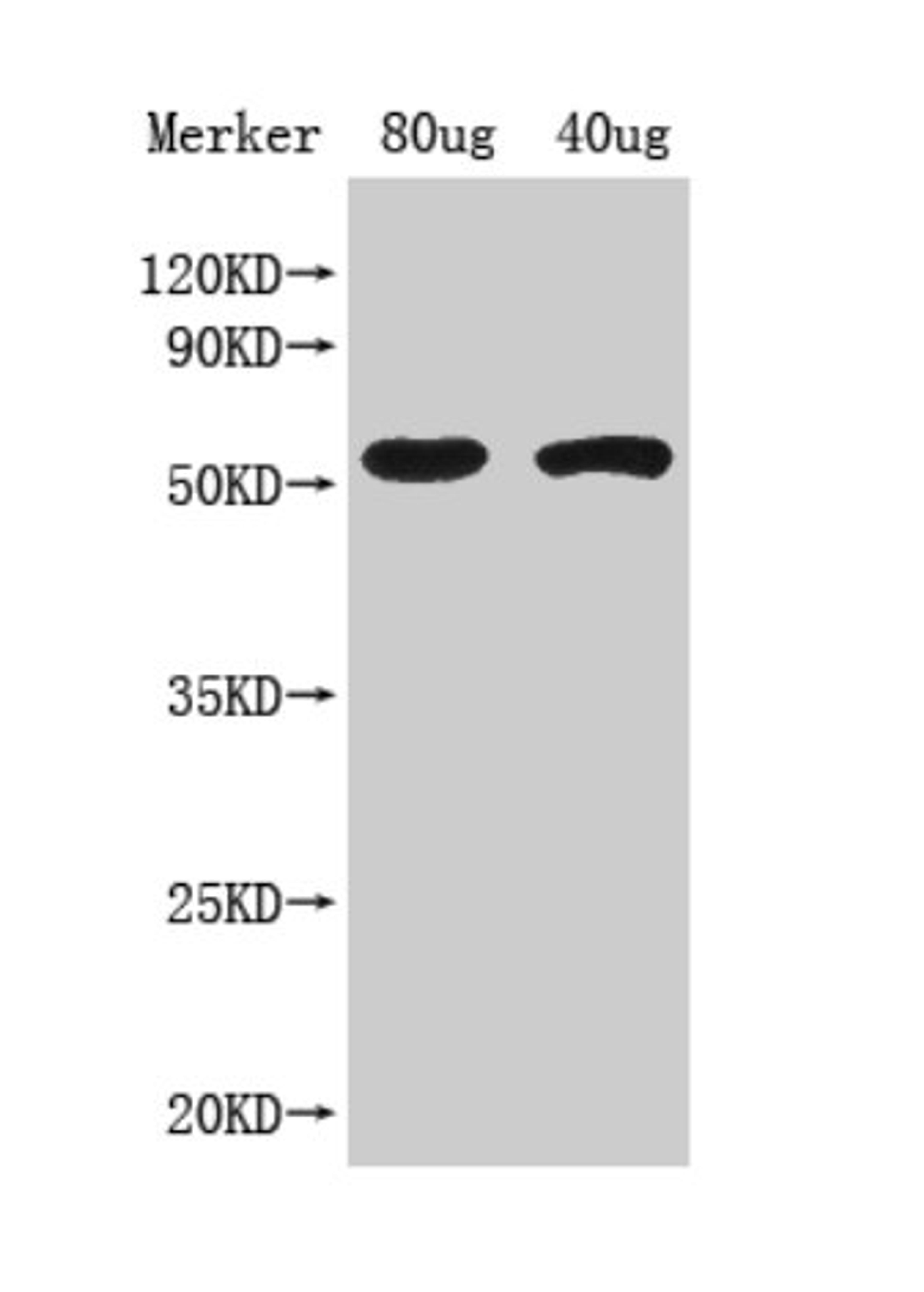 Western Blot. Positive WB detected in Recombinant protein. All lanes: ACS8 antibody at 1:1000. Secondary. Goat polyclonal to rabbit IgG at 1/50000 dilution. Predicted band size: 59 kDa. Observed band size: 59 kDa.