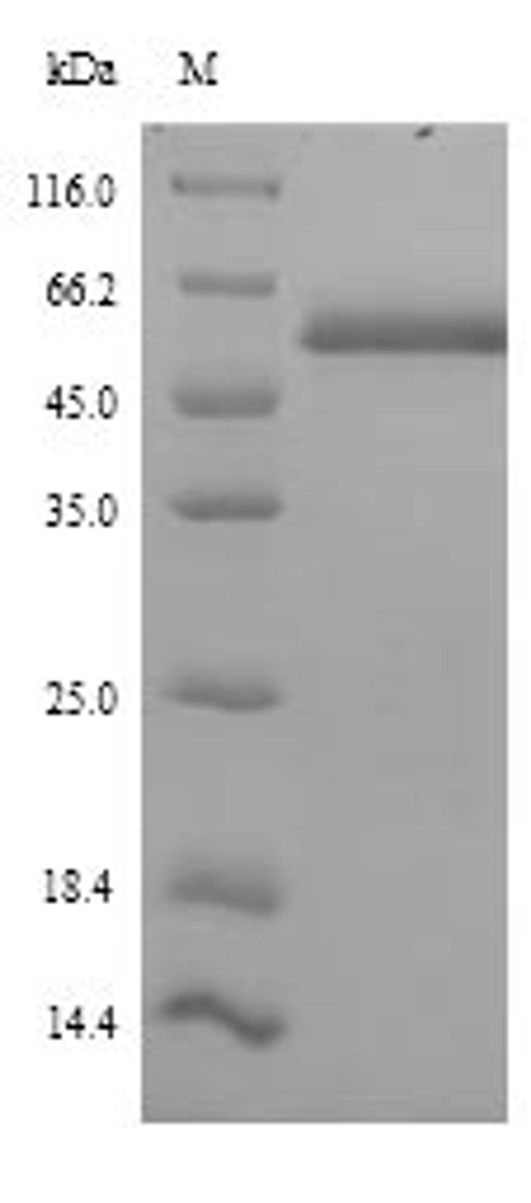 (Tris-Glycine gel) Discontinuous SDS-PAGE (reduced) with 5% enrichment gel and 15% separation gel.