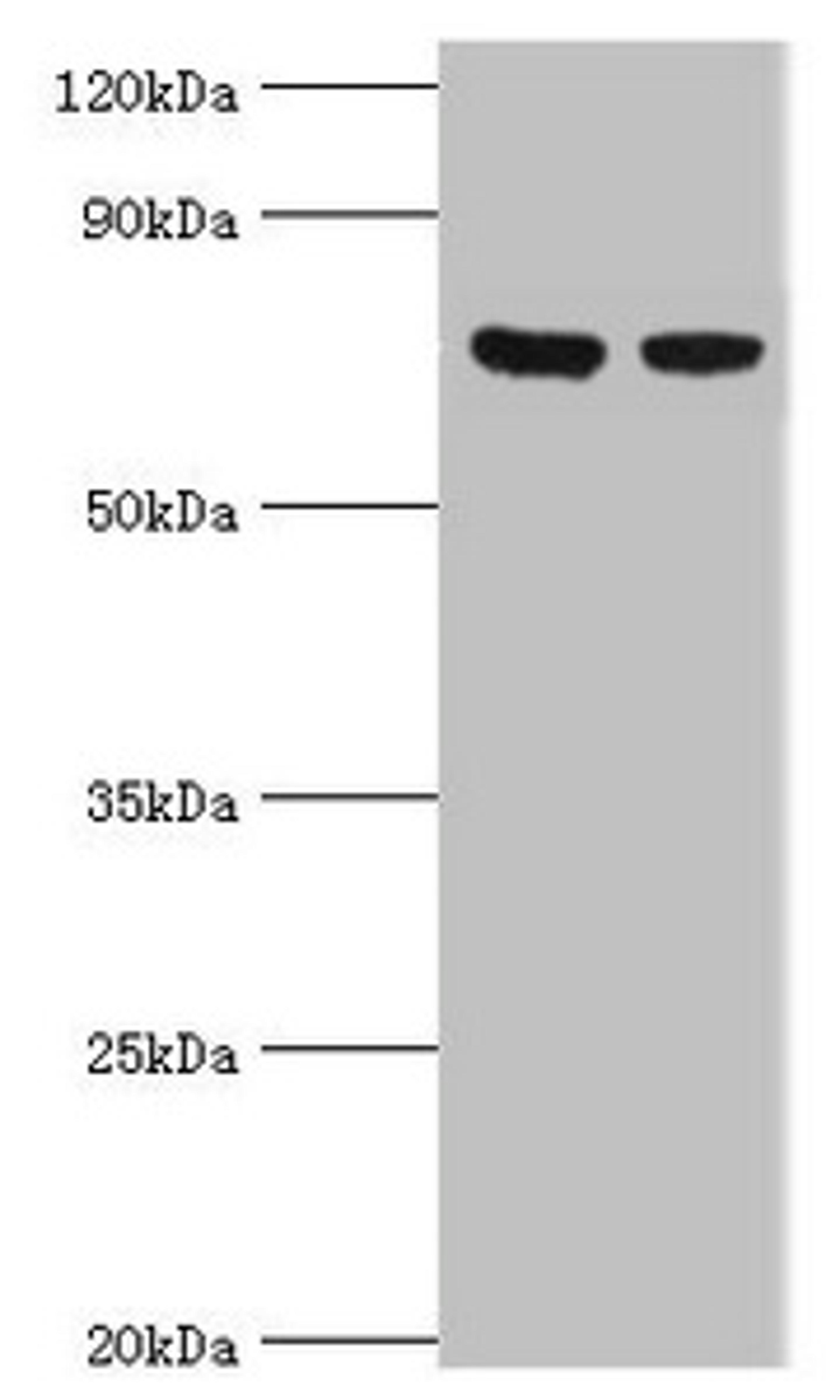 Western blot. All lanes: TCTN2 antibody at 10ug/ml. Lane 1: Jurkat whole cell lysate. Lane 2: A549 whole cell lysate. Secondary. Goat polyclonal to rabbit IgG at 1/10000 dilution. Predicted band size: 77 kDa. Observed band size: 77 kDa.