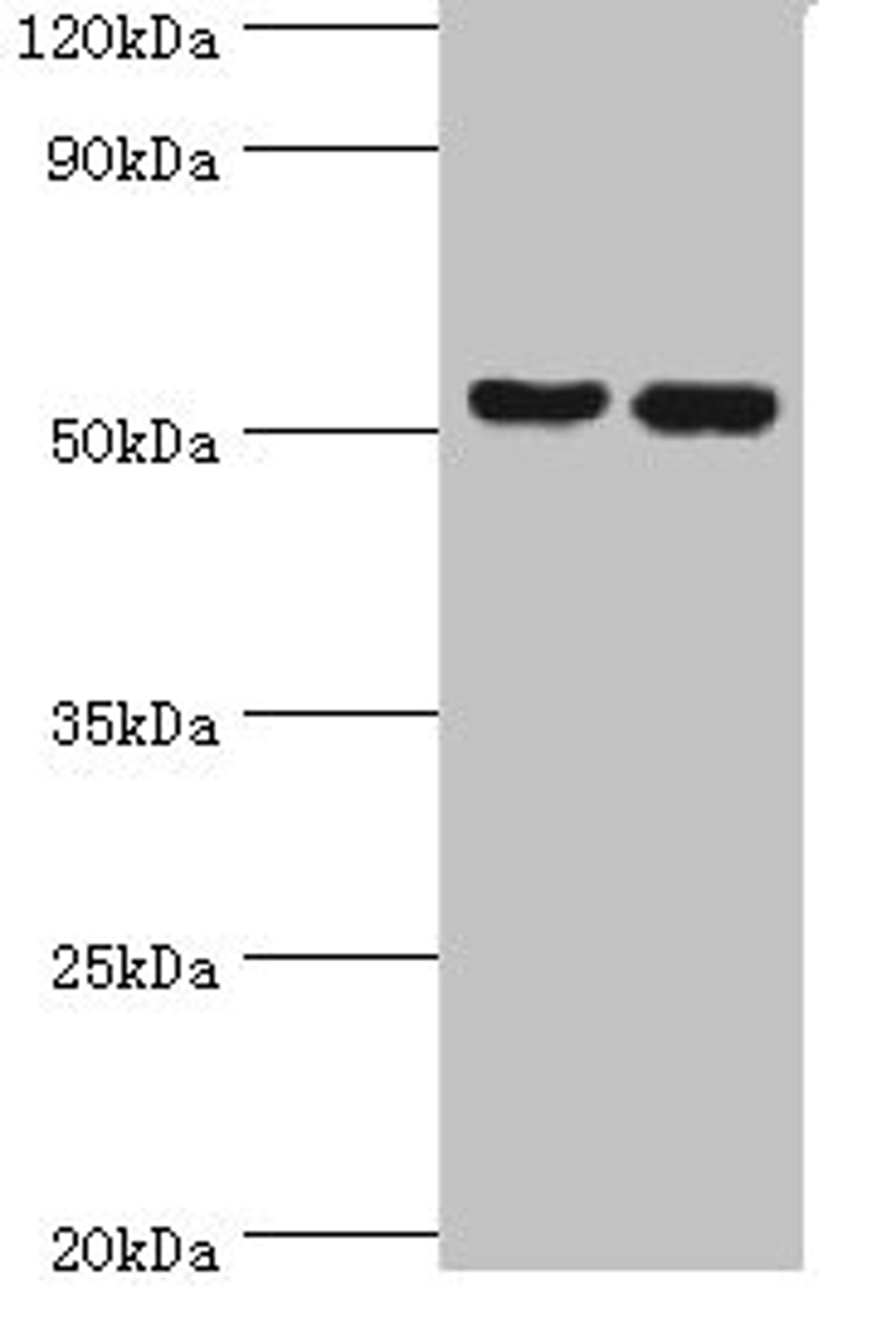 Western blot. All lanes: Peptidyl-prolyl cis-trans isomerase FKBP4 antibody at 1ug/ml. Lane 1: Hela whole cell lysate. Lane 2: MCF-7 whole cell lysate. Secondary. Goat polyclonal to rabbit IgG at 1/10000 dilution. Predicted band size: 52 kDa. Observed band size: 52 kDa.