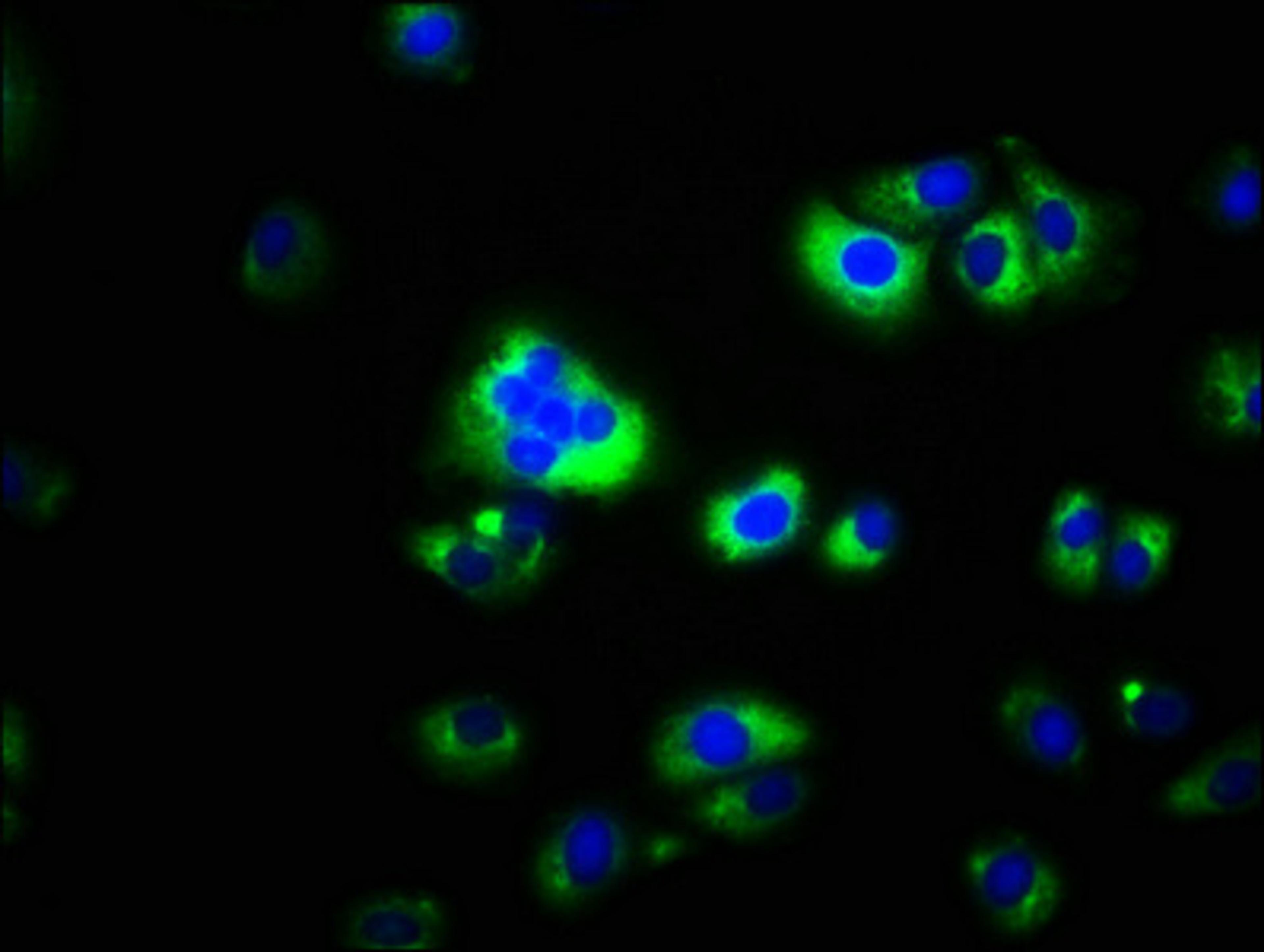 Immunofluorescence staining of A549 cells with CSB-PA822248LA01HU at 1:100, counter-stained with DAPI. The cells were fixed in 4% formaldehyde, permeabilized using 0.2% Triton X-100 and blocked in 10% normal Goat Serum. The cells were then incubated with the antibody overnight at 4&deg;C. The secondary antibody was Alexa Fluor 488-congugated AffiniPure Goat Anti-Rabbit IgG(H+L).