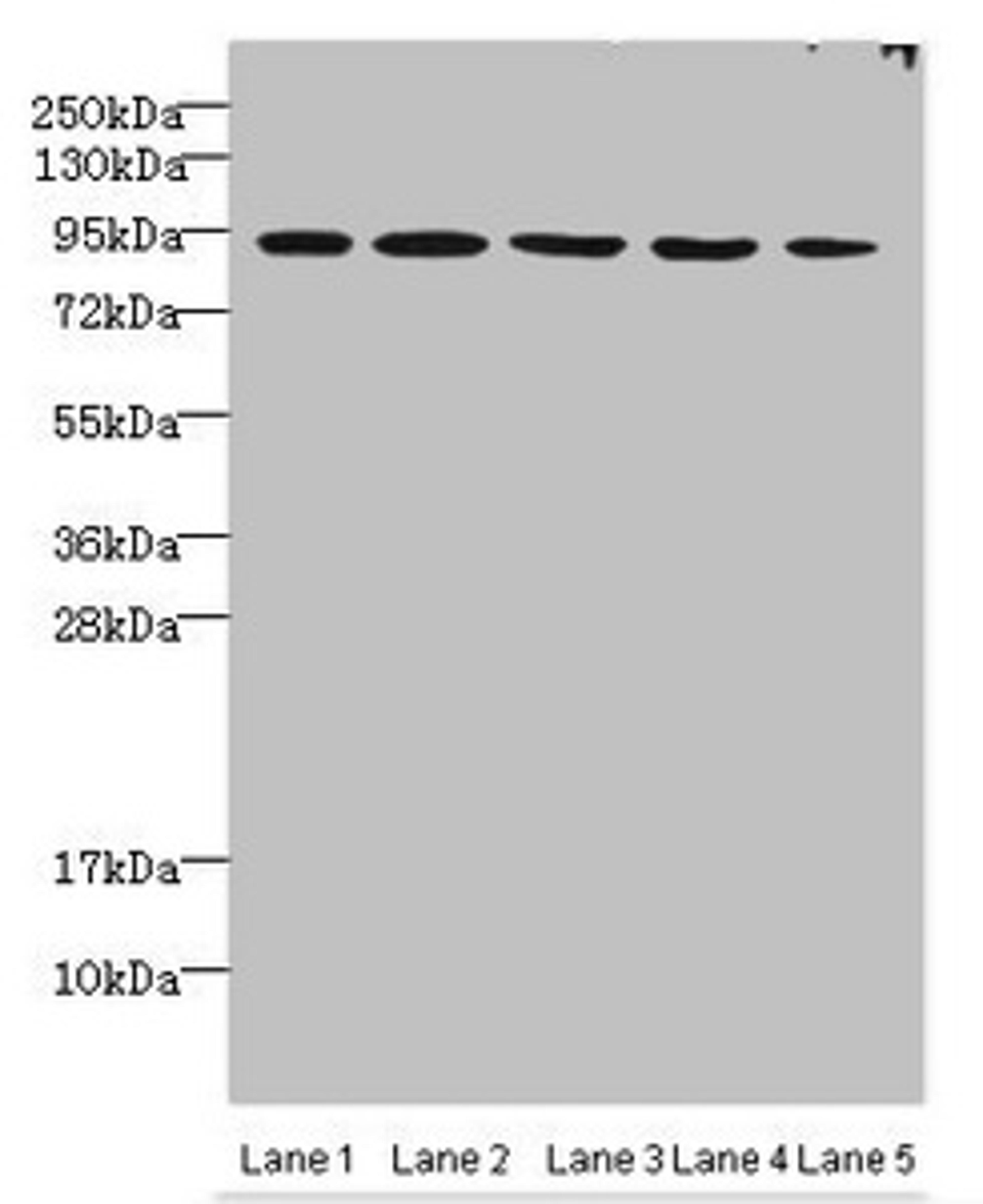 Western blot. All lanes: THOC1 antibody at 3ug/ml. Lane 1: Jurkats whole cell lysate. Lane 2: 293T whole cell lysate. Lane 3: HepG2 whole cell lysate. Lane 4: A549 whole cell lysate. Lane 5: Mouse kidney tissue. Secondary. Goat polyclonal to rabbit IgG at 1/10000 dilution. Predicted band size: 76, 44 kDa. Observed band size: 76 kDa. 