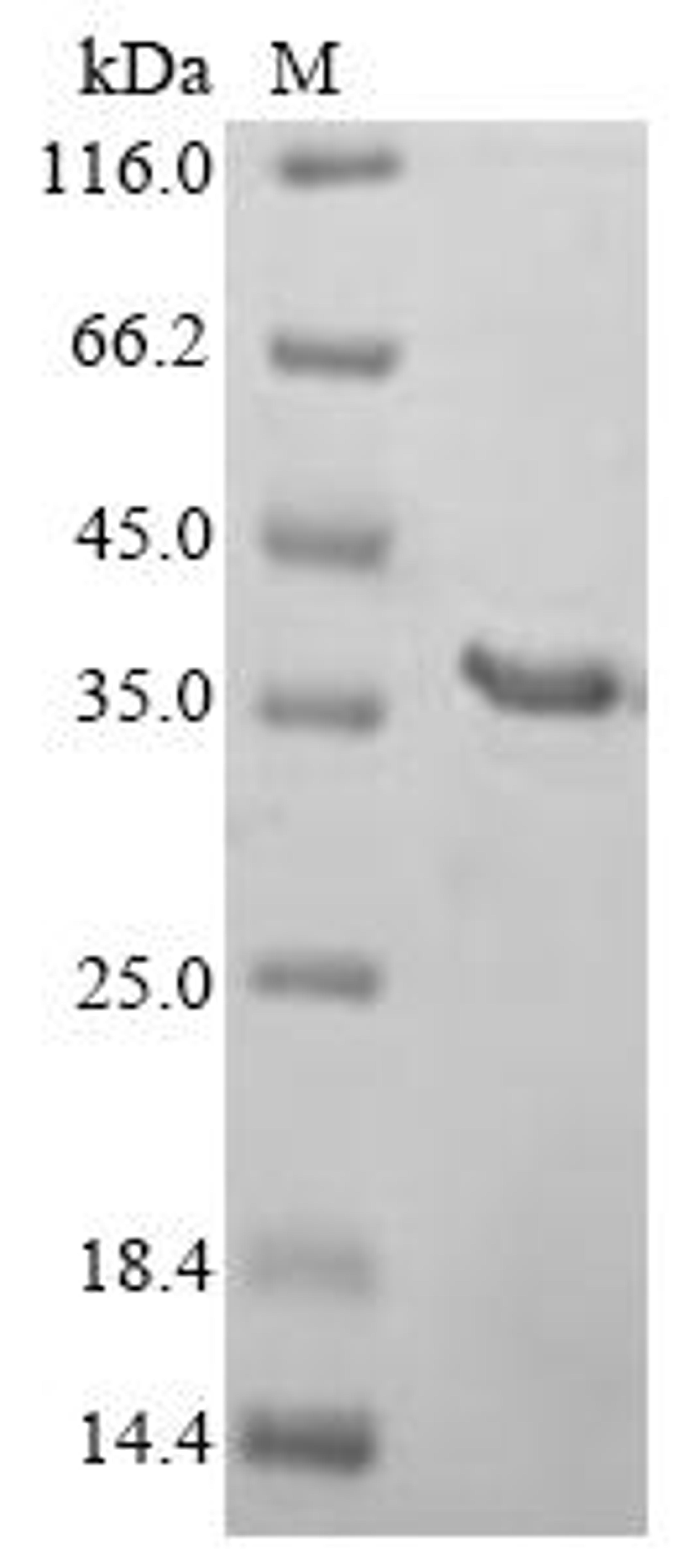 (Tris-Glycine gel) Discontinuous SDS-PAGE (reduced) with 5% enrichment gel and 15% separation gel.