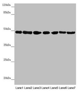 Western blot. All lanes: UQCRC2 antibody at 2.95µg/ml. Lane 1: Human placenta tissue. Lane 2: Mouse large intestine tissue. Lane 3: Mouse small intestine tissue. Lane 4: Mouse brain tissue. Lane 5: HepG2 whole cell lysate. Lane 6: Jurkat whole cell lysate. Lane 7: 293T whole cell lysate. Secondary. Goat polyclonal to rabbit IgG at 1/10000 dilution. Predicted band size: 48 kDa. Observed band size: 48 kDa