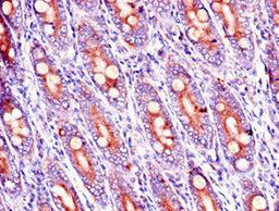 Immunohistochemistry of paraffin-embedded human small intestine tissue using CSB-PA822194LA01HU at dilution of 1:100