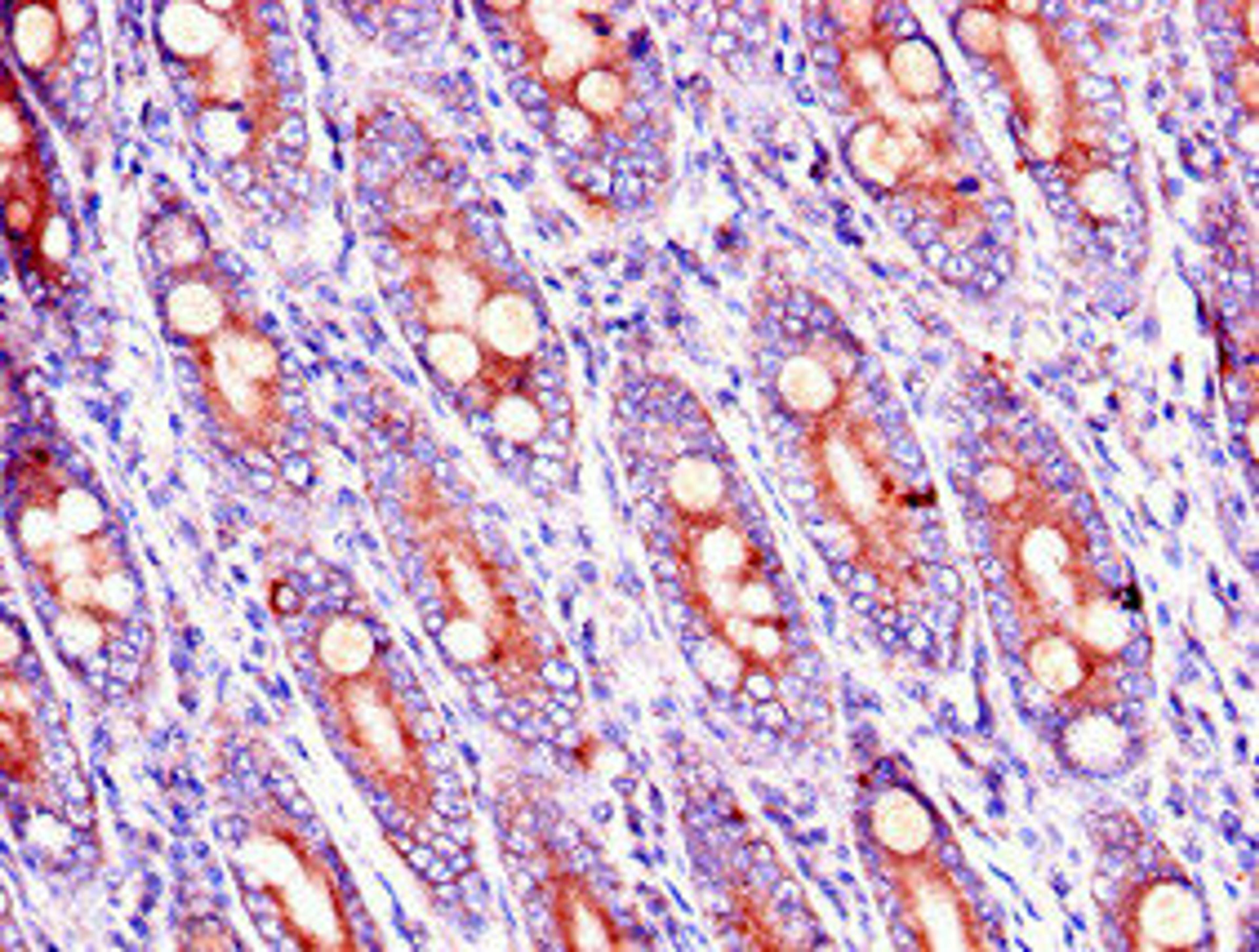 Immunohistochemistry of paraffin-embedded human small intestine tissue using CSB-PA822194LA01HU at dilution of 1:100