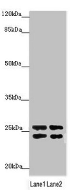 Western blot. All lanes: GRPEL1 antibody at 2.65µg/ml. Lane 1: A431 whole cell lysate. Lane 2: 293T whole cell lysate. Secondary. Goat polyclonal to rabbit IgG at 1/10000 dilution. Predicted band size: 24 kDa. Observed band size: 24, 26 kDa