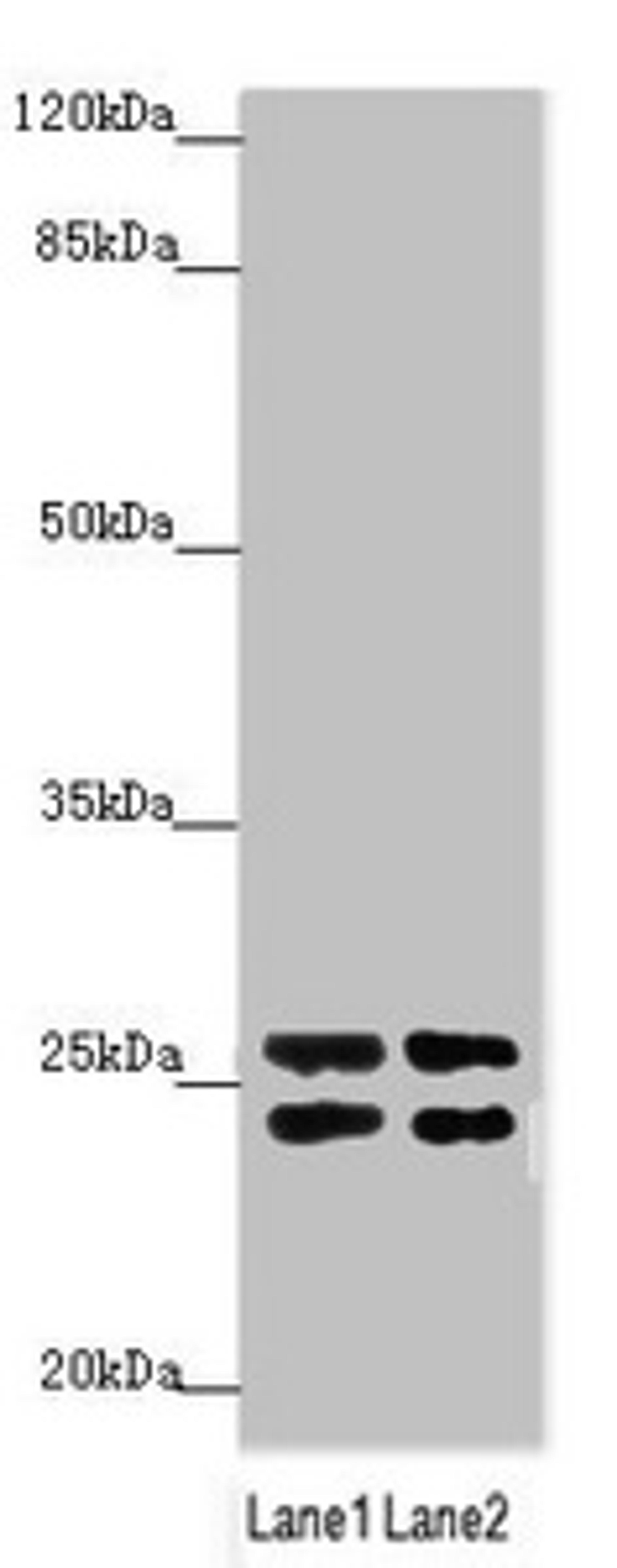 Western blot. All lanes: GRPEL1 antibody at 2.65µg/ml. Lane 1: A431 whole cell lysate. Lane 2: 293T whole cell lysate. Secondary. Goat polyclonal to rabbit IgG at 1/10000 dilution. Predicted band size: 24 kDa. Observed band size: 24, 26 kDa