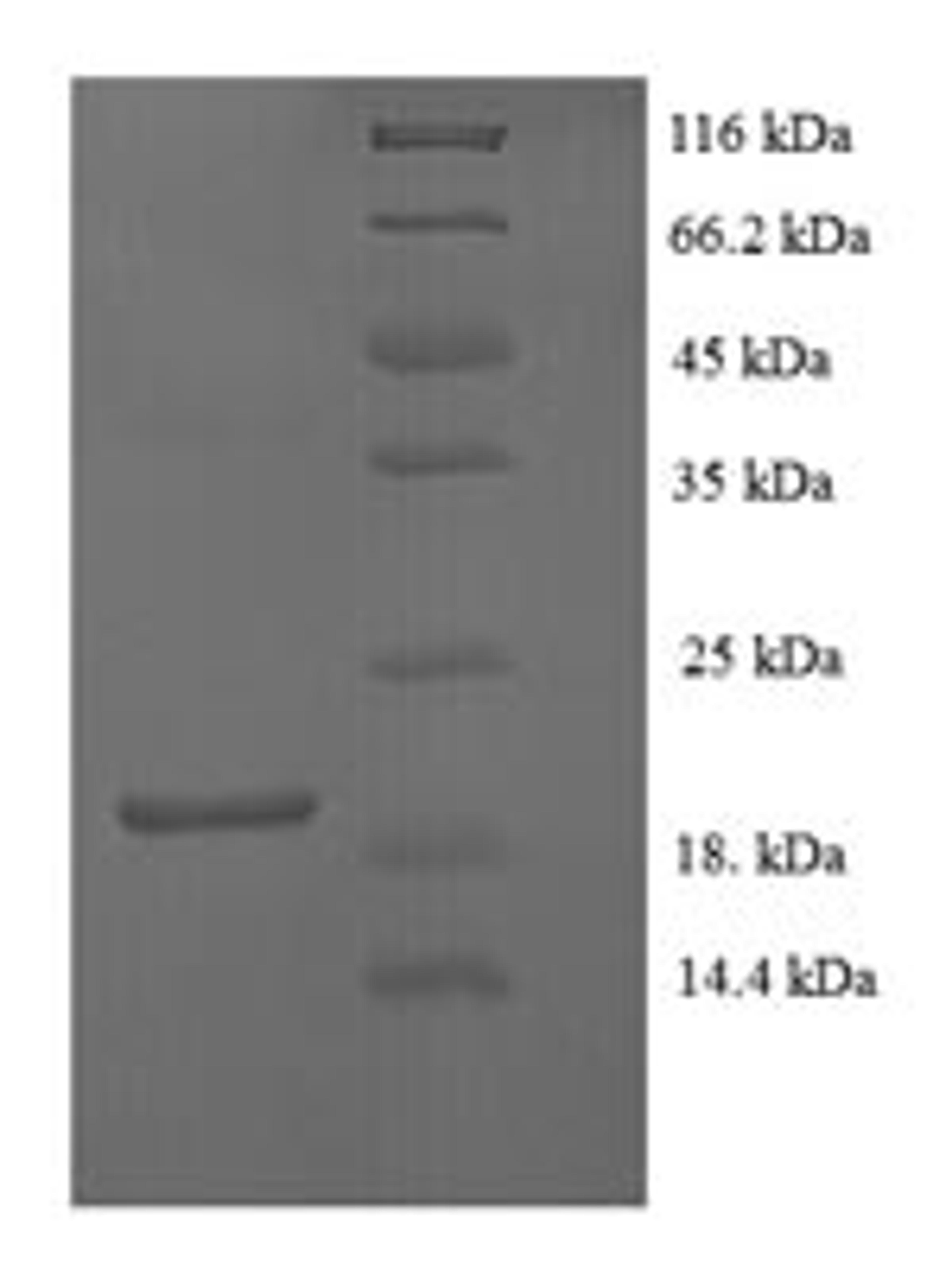 (Tris-Glycine gel) Discontinuous SDS-PAGE (reduced) with 5% enrichment gel and 15% separation gel.