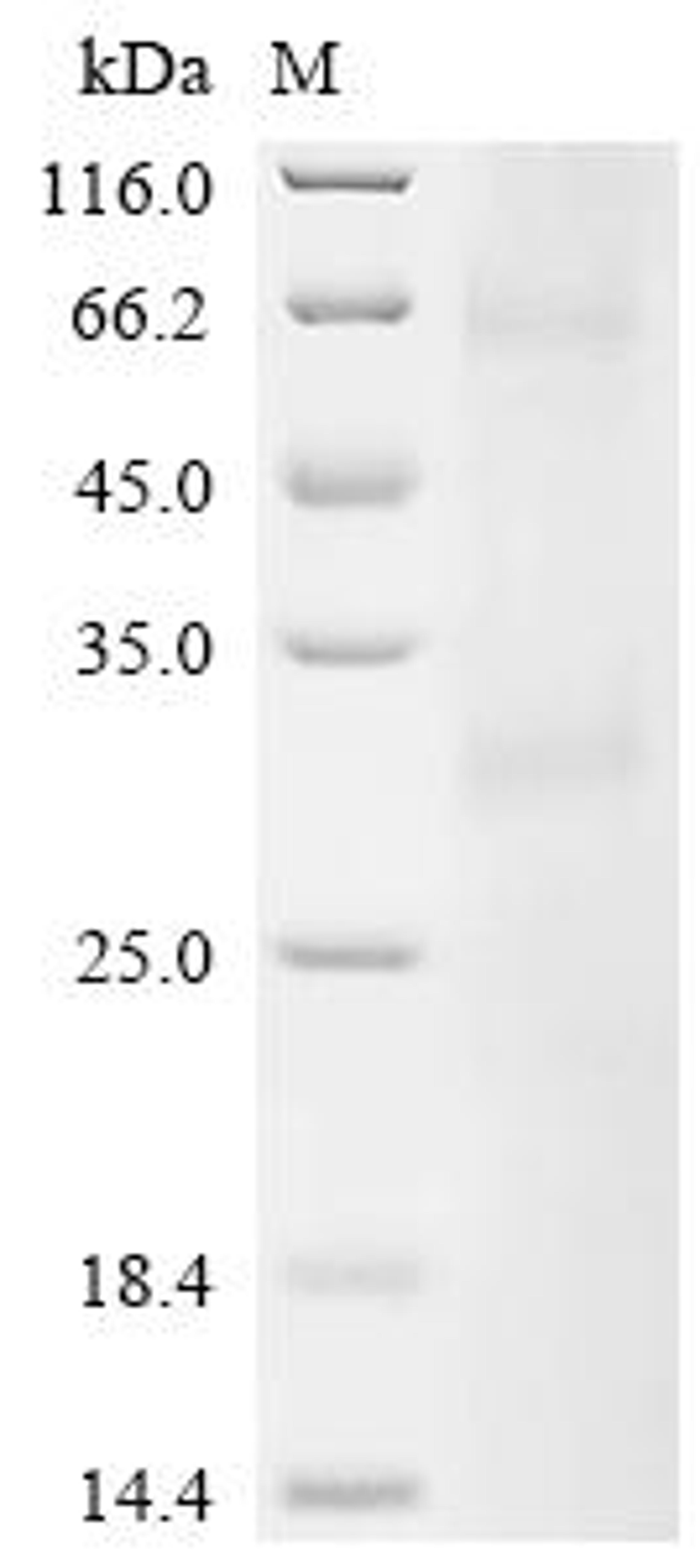 (Tris-Glycine gel) Discontinuous SDS-PAGE (reduced) with 5% enrichment gel and 15% separation gel.