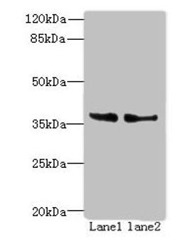 Western blot. All lanes: POLR3F antibody at 8ug/ml. Lane 1: Hela whole cell lysate. Lane 2: HepG2 whole cell lysate. Secondary. Goat polyclonal to rabbit IgG at 1/10000 dilution. Predicted band size: 36 kDa. Observed band size: 36 kDa. 